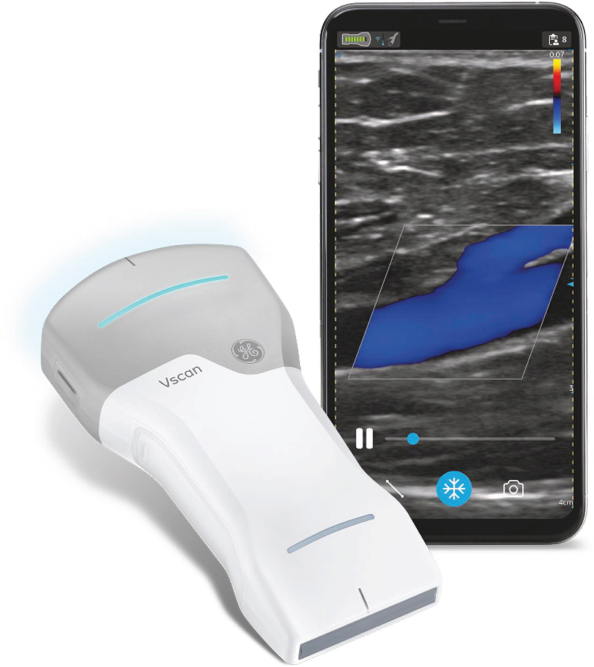 Wireless Point Of Care Ultrasound First Experiences With A New Generation Handheld Device Ios 9520