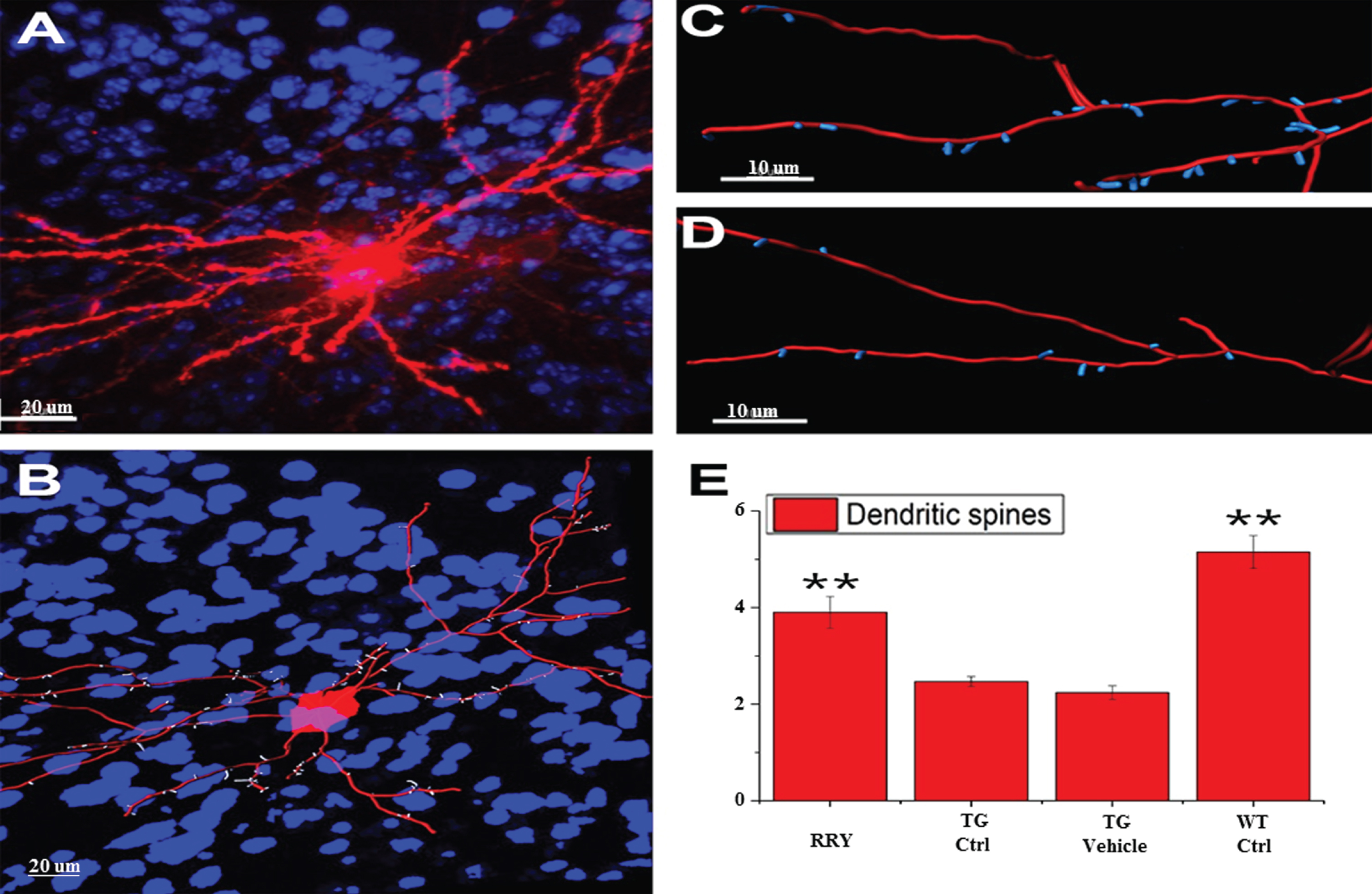 Demonstration of the reconstruction and quantification of the DiI-labeled neuron in mice and increase in the density of the dendritic spines by RRY in the brains of the APP/PS1 transgenic mice. A) An image of DiI-labeled neuron in the brain of the APP/PS1 Tg mouse administered with RRY (Red: DiI, Blue: DAPI). B) The reconstructed neuron of the APP/PS1 Tg mouse administered with RRY (Red: dendrites and cell body, Blue: nuclus of surrounding cells, white: dendritic spines). C and D showed the comparison of the density of the dendritic spines between the groups RRY (C) and Tg Ctrl (D). E) RRY increased the density of the dendritic spines in the dentate gyrus of the hippocampus of the APP/PS1 Tg mice compared to the groups Tg Ctrl and Tg Vehicle (n = 4, **p < 0.01).