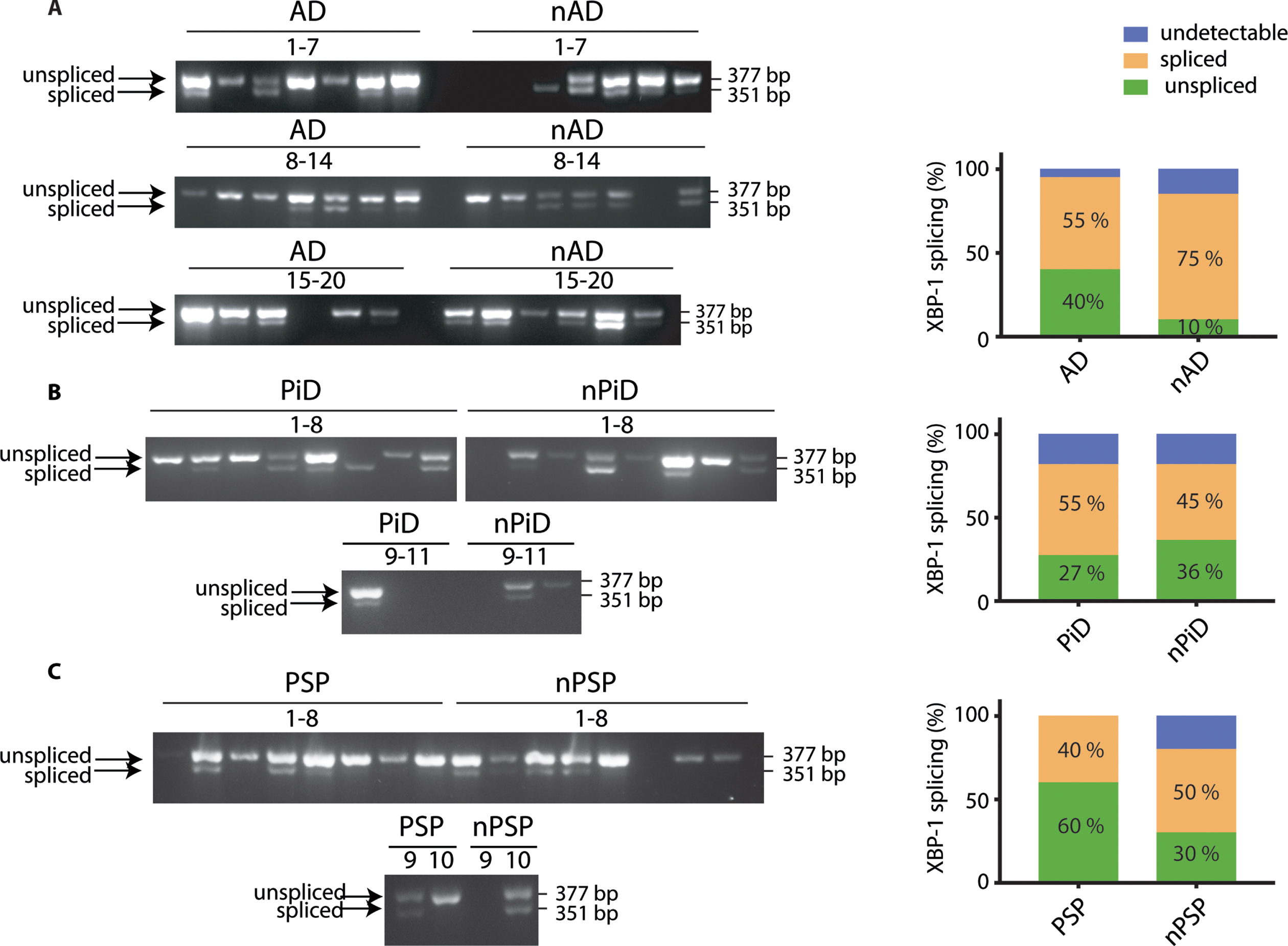 XBP-1 splicing in tauopathies and age-matched control brains. cDNA from brain samples from (A) AD, (B) PiD, and (C) PSP together with respective non-demented controls were subjected to PCR with primers designed to amplify the unspliced and spliced variants of XBP-1. The products were resolved on a 2.5%agarose gel. The PCR products were classified as undetectable, spliced, or unspliced, and the distinct PCR outcomes are expressed as percentage of total samples and analyzed using Fisher’s exact test for (A) AD (p = 0.1560), (B) PiD (p = 0.9999), and (C) PSP samples (p = 0.6372). Number of cases: ND = 20, AD = 20, nPiD = 11, PiD = 11, nPSP = 10, PSP = 10. Each lane corresponds to one individual case.
