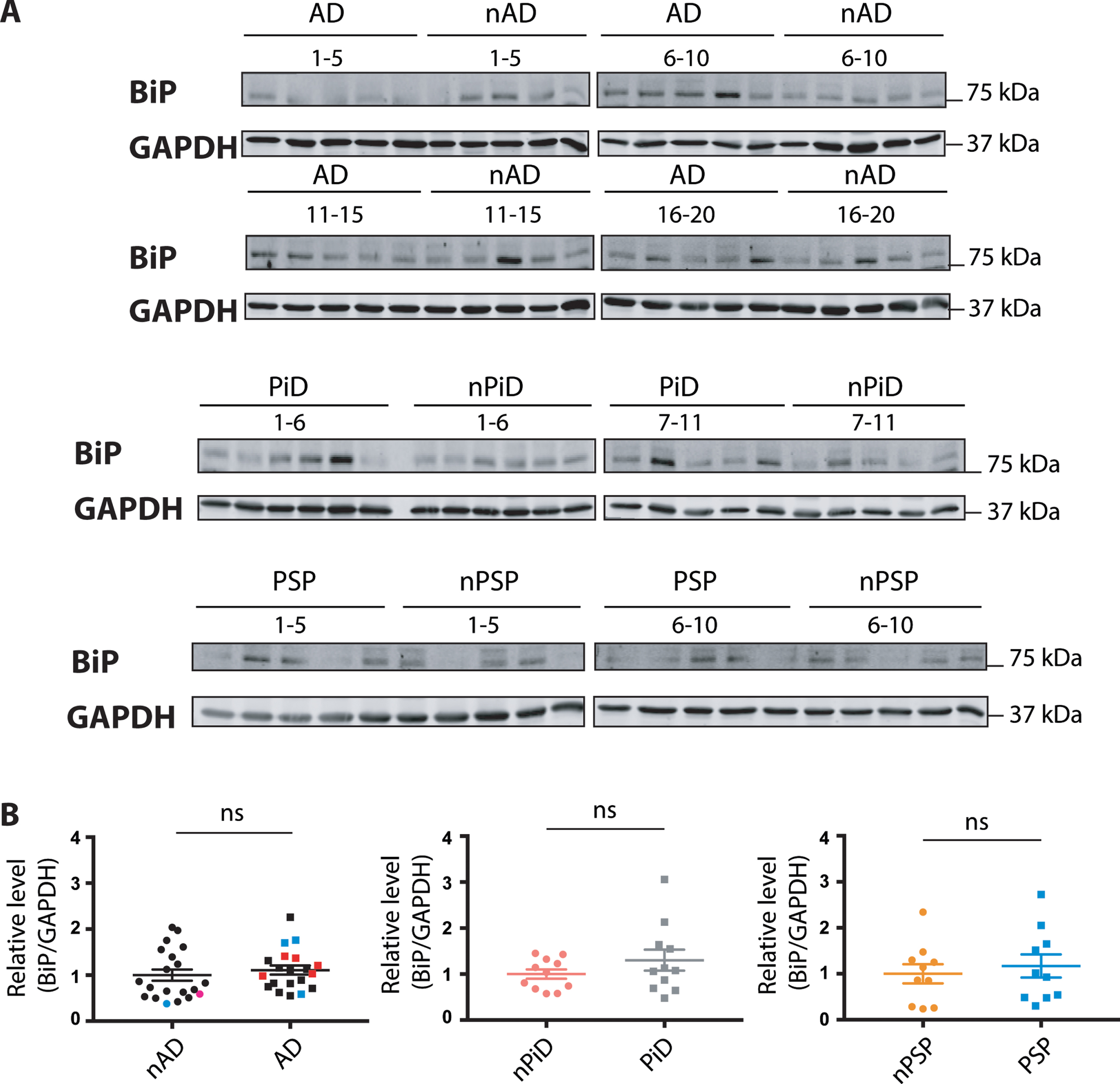 BiP protein expression in tauopathies and age-matched non-demented controls. A) BiP and GAPDH immunoreactivity for AD, PiD, and PSP together with relative age-matched non-demented controls. B) Quantification of BiP immunoreactivity from individual samples was normalized to the immunoreactivity of a loading control, GAPDH. Data were analyzed using a Mann-Whitney test (AD, PiD) or two-tailed unpaired t-test (PSP) revealing no significant differences (p = 0.2888 and U = 160, p = 0.4779 and U = 49, p = 0.6099 and t = 0.5193 for AD, PiD disease and PSP, respectively). Shown are means, error bars are SEM. ns, not significant. Number of cases: ND = 20, AD = 20, nPiD = 11, PiD = 11, nPSP = 10, PSP = 10. Each lane corresponds to one individual case. Colored symbols for nAD, AD cases correspond to individuals with LBD co-morbidity (red), APOE 4.4 genotype (blue), and CVD co-morbidity (magenta).