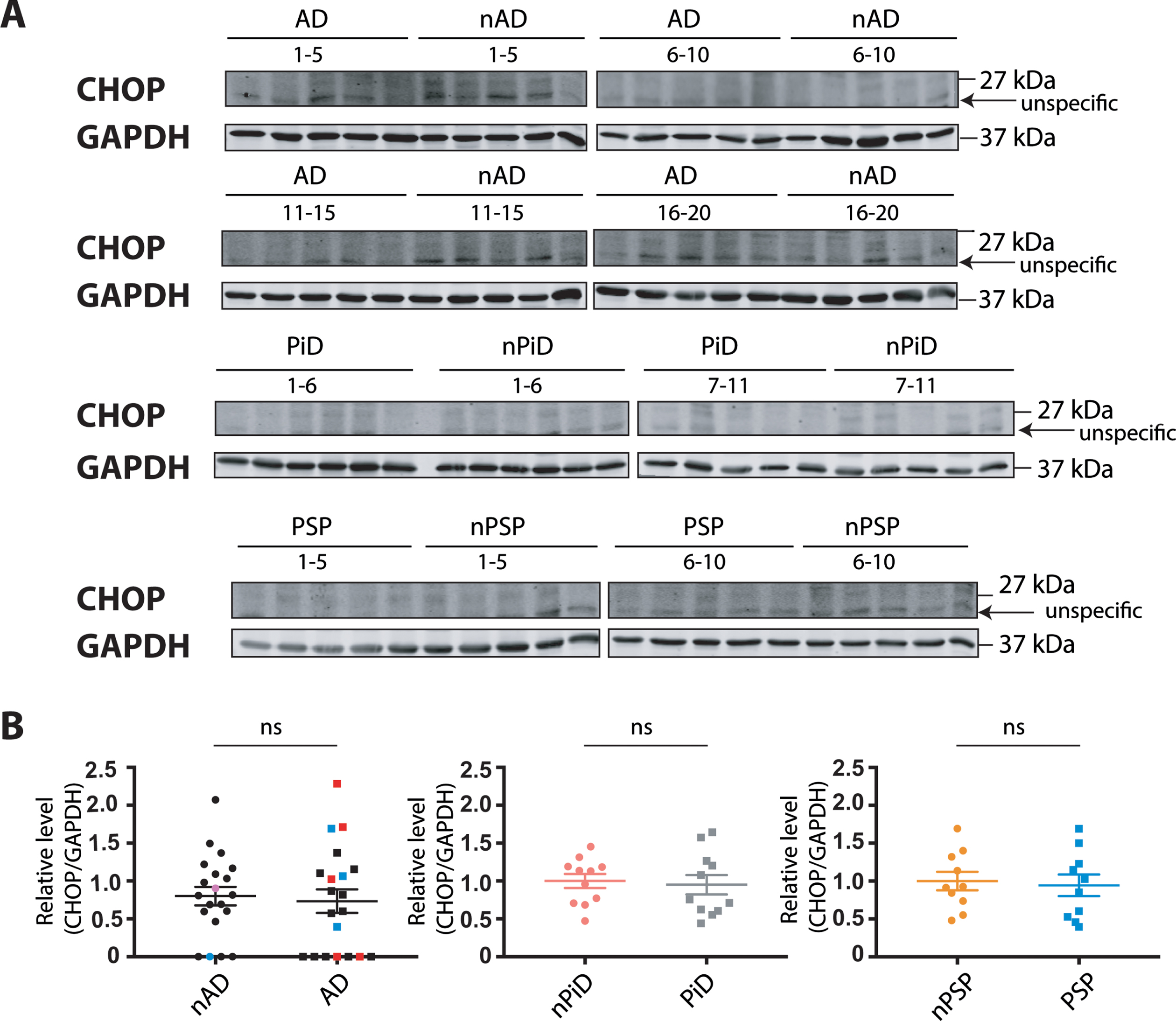 CHOP protein expression in tauopathies and age-matched non-demented controls. A) CHOP and GAPDH immunoreactivity for AD, PiD, and PSP together with relative age-matched non-demented controls. B) Quantification of CHOP immunoreactivity from individual samples was normalized to the immunoreactivity of a loading control, GAPDH. Data were analyzed using Mann-Whitney test (AD) or two-tailed unpaired t-test (PiD and PSP) revealing no significant differences (p = 0.6749 and U = 184, p = 0.7539 and t = 0.3178, p = 0.7649 and t = 0.3036 for AD, PiD, and PSP, respectively). Shown are means, error bars are SEM. ns, not significant. Number of cases: ND = 20, AD = 20, nPiD = 11, PiD = 11, nPSP = 10, PSP = 10. Each lane corresponds to one individual case. Colored symbols for nAD, AD cases correspond to individuals with LBD co-morbidity (red), APOE 4.4 genotype (blue), and CVD co-morbidity (magenta).