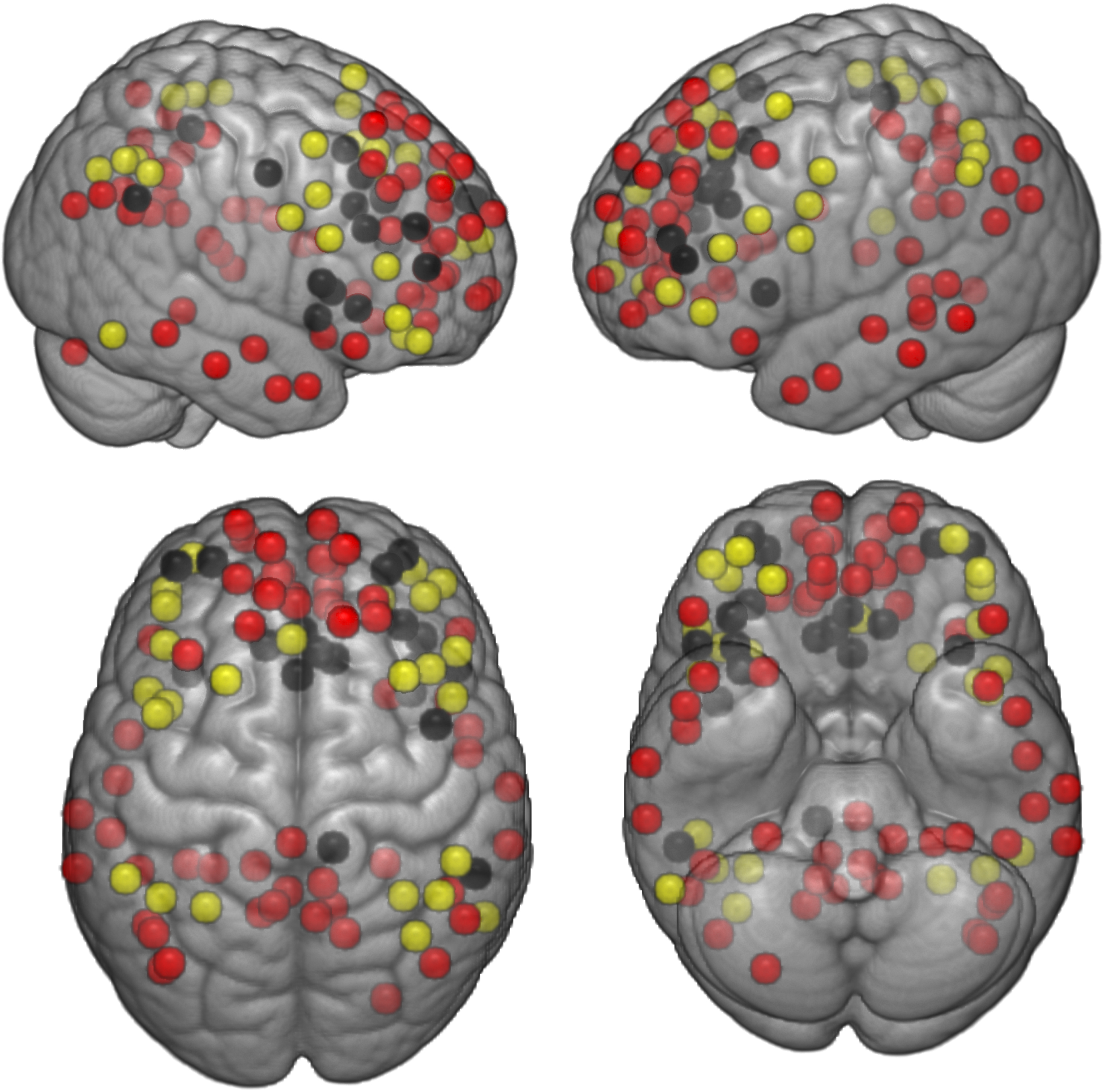 Location of the nodes for each network defined by Power (2011) atlas [44]. Red: DMN (59 nodes); Yellow: FPN (25 nodes); and Black: SAL (18 nodes). Detailed coordinates for each node are presented in Supplementary Table 1.