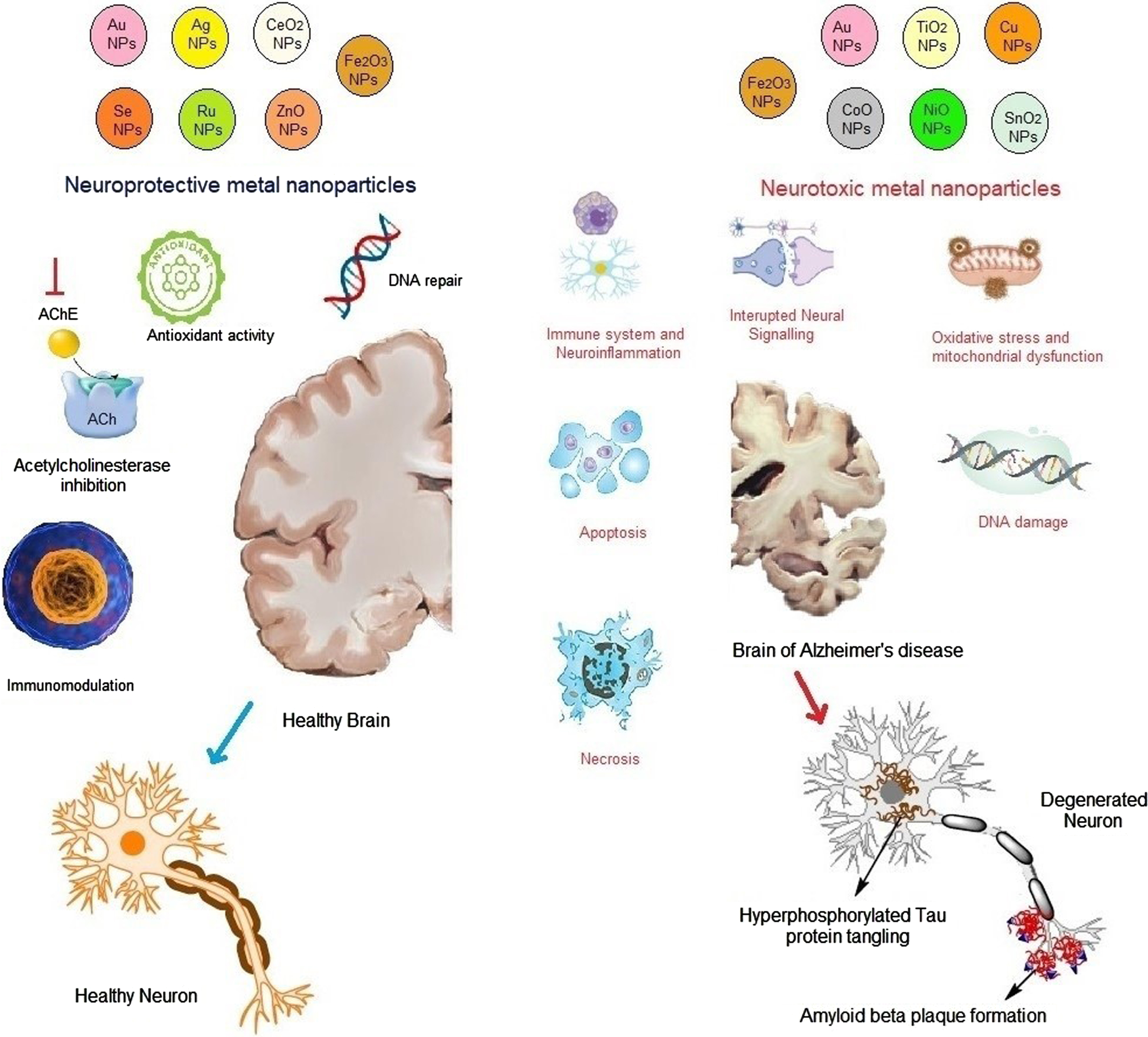 Neuroprotective and neurotoxic mechanisms of metal nanoparticles affecting Alzheimer’s disease (AD). The mechanisms of action of different metal nanoparticles against AD are discussed. Some of the metal nanoparticles such as Au, ZnO, Se, Ag, CeO2, and Ru possess neuroprotective action by modulating oxidative stress activity, acetylcholinesterase levels, and inflammation. In contrast, Cu, NO, SnO2, TiO2, and Fe2O3 are responsible for the occurrence of AD by increasing the amyloid-β plaque formation, neurofibrillary tangles of hyperphosphorylated tau, necrosis and apoptosis, and degeneration in the neuronal activity and the levels of reactive oxygen species.