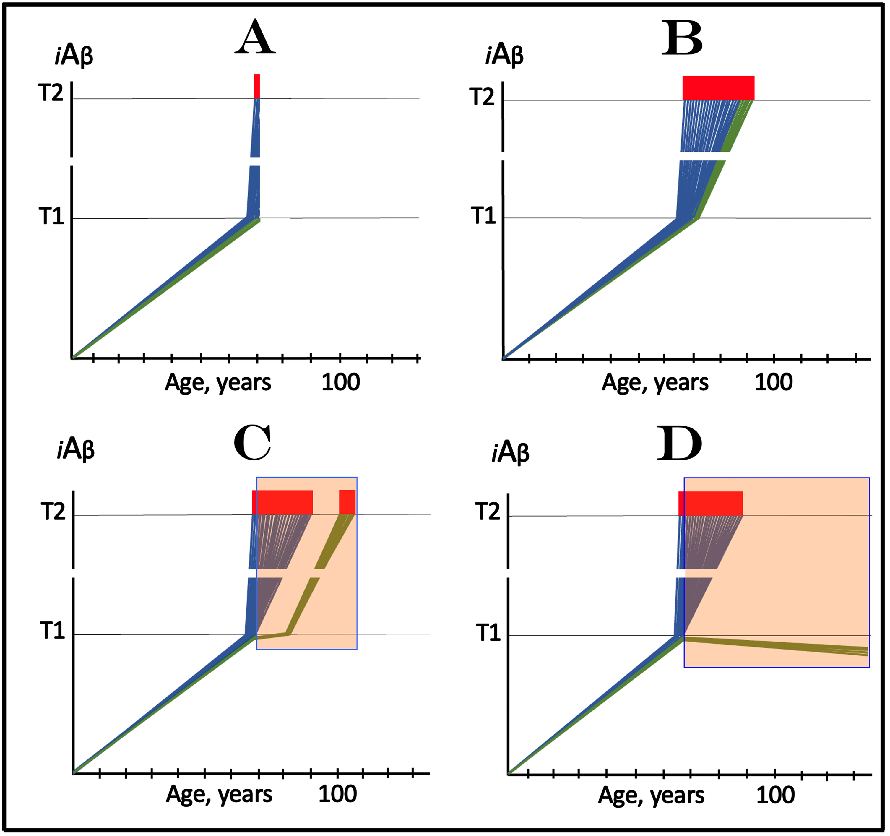 Effect of lecanemab and donanemab in early symptomatic AD. Blue and green lines: Individual affected neurons. Green lines: A fraction of affected neurons that have not reached the T1 threshold at the start of lecanemab or donanemab treatment. iAβ: Level of intraneuronal Aβ. T1 threshold: Levels of iAβ triggering, plausibly via activation of PKR and HRI kinases, elicitation of the ISR and initiation of AβPP-independent production of iAβ. T2 threshold: Levels of iAβ triggering neuronal entrance into the apoptotic pathway. Red blocks: Apoptotic zone. Orange fields: The duration of lecanemab or donanemab treatment. Panel A: The initial state of iAβ levels in affected neurons at the start of treatment. Panel B: Evolution of the initial state in the absence of a treatment. The “green” neuronal fraction reaches the T1 threshold, iAβ levels in both neuronal fractions crosses the T2 threshold and AD enters the end-stage. Panels C and D: Evolution of the initial state in the presence of the drug; note that the drug has no effect over the T1 threshold. Panel C: The rate of accumulation of AβPP-derived iAβ in “green” neuronal fraction is reduced but its levels continue to increase. Eventually, they reach the T1 threshold, cross the T2 threshold and cells commit apoptosis. The fate of the “green” neuronal population is the same as in panel B but occurs with a delay. Panel D: The drug reverses the accumulation of AβPP-derived iAβ. Levels of AβPP-derived iAβ do not reach the T1 threshold in the “green” neuronal fraction; it is redeemed for the duration of the treatment.