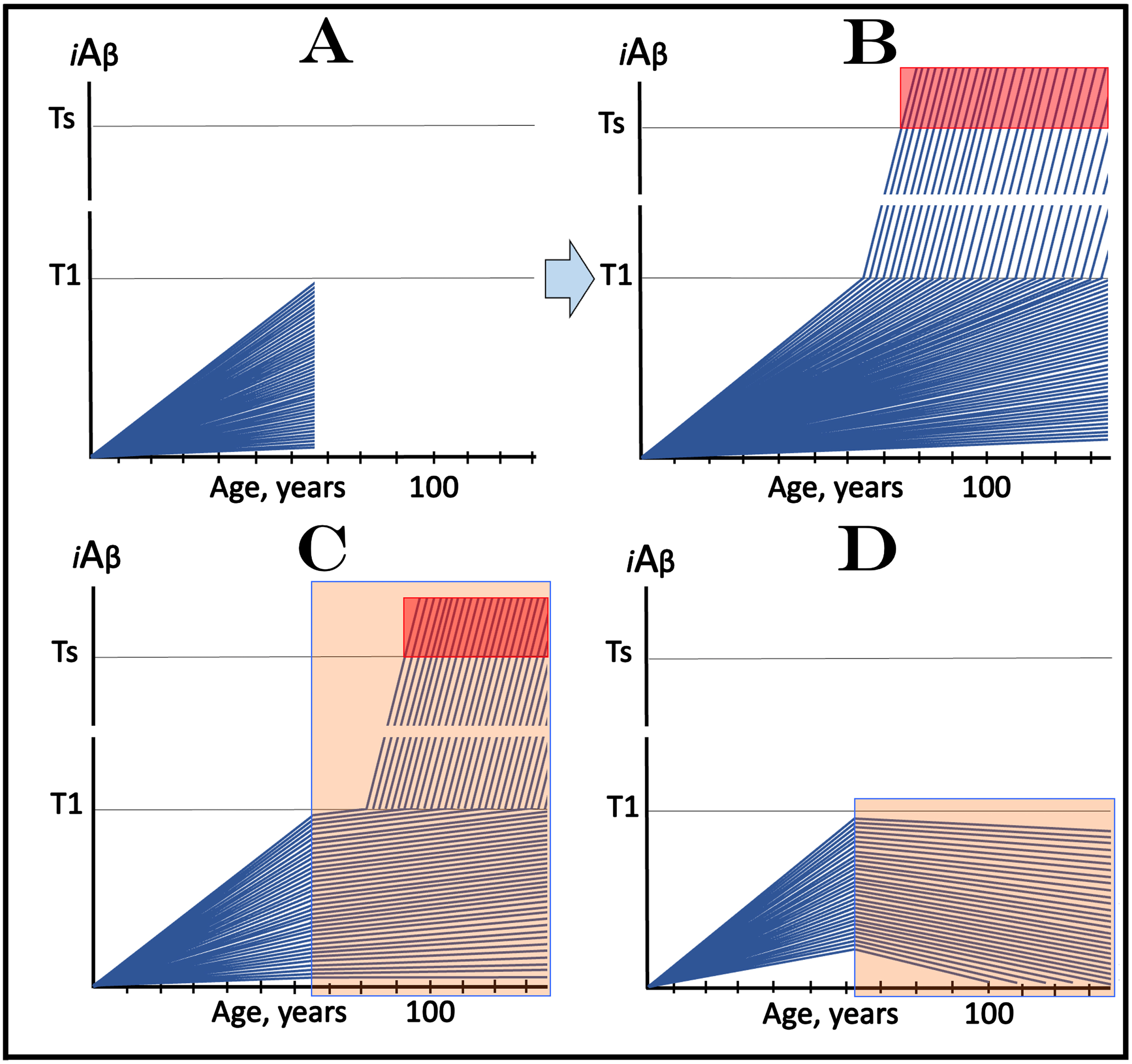 Design and outcomes of clinical trials of drugs targeting the influx of AβPP-derived iAβ in prevention of AD, with all participants at sub-T1 levels of iAβ. iAβ: Level of intraneuronal Aβ. Blue lines: iAβ levels in individual trial participants. T1 threshold: Levels of iAβ triggering, plausibly via activation of PKR and HRI kinases, elicitation of the ISR and initiation of AβPP-independent production of iAβ. Ts threshold: Levels of iAβ triggering manifestation of AD symptoms. Pink fields: AD Symptomatic Zone. Orange fields: The duration of the treatment. Note that the treatment commences prior to the crossing of the T1 threshold in all participants and that the drug has no effect over the T1 threshold. Panel A: The initial state of iAβ levels in individual participants at the start of treatment. Panel B: Evolution of the initial state in the absence of a treatment results in two distinct outcomes. In a fraction of participants the rate of accumulation of iAβ is such that it does not cross the T1 threshold within the lifetime of an individual. In those participants where the T1 crossing occurs, the AβPP-independent pathway of iAβ production is activated, its rate of accumulation increases, its levels cross the Ts threshold and AD symptoms manifest. Panels C and D: Evolution of the initial state in the presence of the drug. Panel C: The rate of accumulation of AβPP-derived iAβ is reduced but its levels continue to increase. In some subjects, eventually, they reach the T1 threshold and cross into the Symptomatic Zone; the outcome is the same as in panel B but occurs with a delay. In other subjects the delay is sufficient to prevent the T1 crossing and the occurrence of the disease within the lifetime of an individual. Panel D: The drug reverses the accumulation of AβPP-derived iAβ. Its levels do not reach the T1 threshold and no disease occurs in all trial subjects for the duration of the treatment.