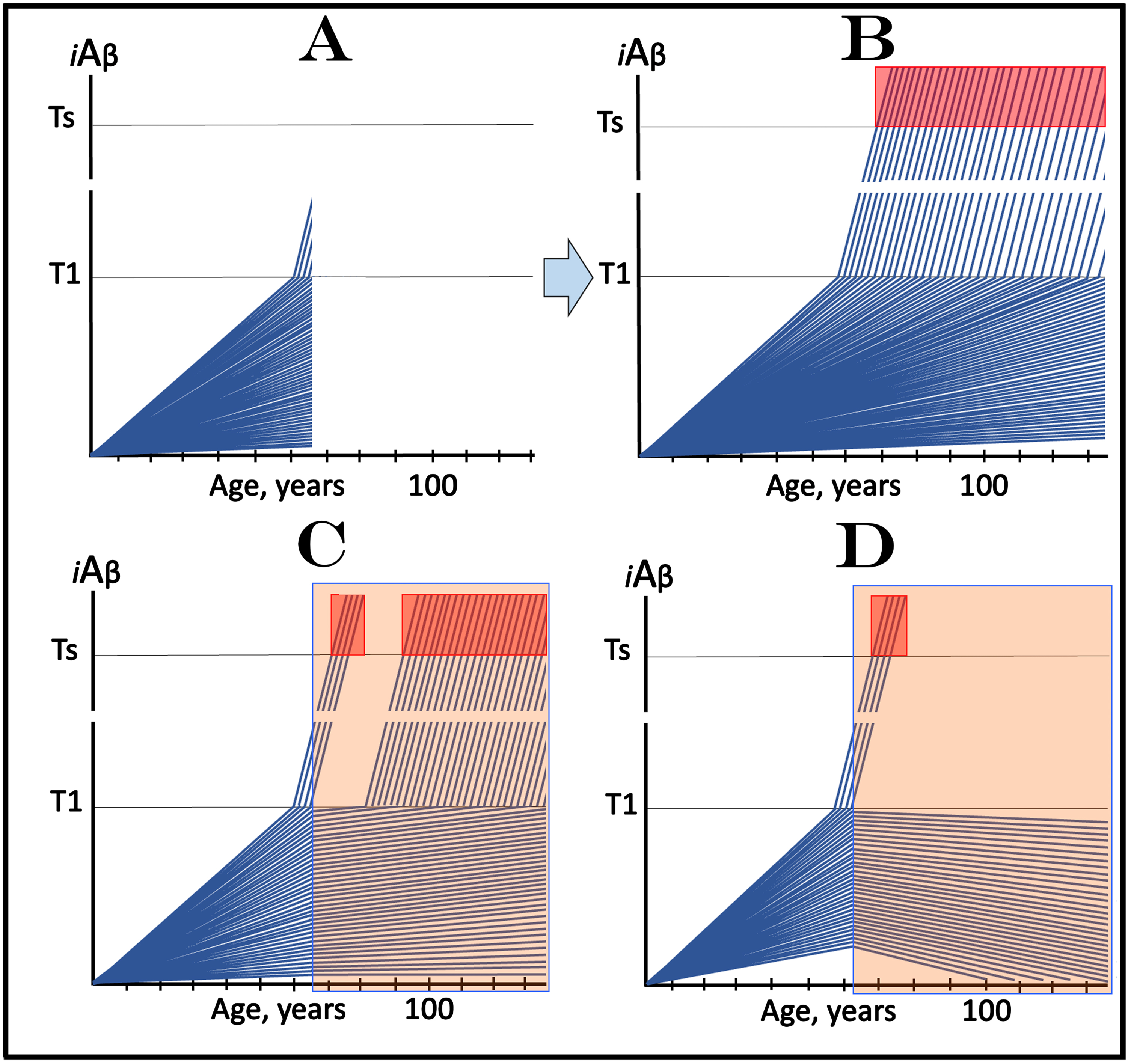 Design and outcomes of clinical trials of drugs targeting the influx of AβPP-derived iAβ in prevention of AD, with a fraction of asymptomatic participants at over-T1 levels of iAβ. iAβ: Level of intraneuronal Aβ. Blue lines: iAβ levels in individual trial participants. T1 threshold: Levels of iAβ triggering, plausibly via activation of PKR and HRI kinases, elicitation of the ISR and initiation of AβPP-independent production of iAβ. Ts threshold: Levels of iAβ triggering manifestation of AD symptoms. Pink fields: AD Symptomatic Zone. Orange fields: The duration of the treatment. Note that the treatment commences prior to the crossing of the T1 threshold in all participants and that the drug has no effect over the T1 threshold. Panel A: The initial state of iAβ levels in individual participants at the start of treatment; note that in a fraction they are over the T1 threshold. Panel B: Evolution of the initial state in the absence of a treatment results in two distinct outcomes. In a fraction of participants the rate of accumulation of iAβ is such that it does not cross the T1 threshold within the lifetime of an individual. In those where the T1 crossing occurs (or occurred, i.e., the initial over-T1 fraction), the AβPP-independent pathway of iAβ production is activated, its rate of accumulation increases, its levels cross the Ts threshold and AD symptoms manifest. Panels C and D: Evolution of the initial state in the presence of the drug. Panel C: With the exception of the initial over-T1 fraction, the rate of accumulation of AβPP-derived iAβ is reduced but its levels continue to increase. Eventually, they reach the T1 threshold and cross into the Symptomatic Zone but with a delay; in some subjects the delay is sufficient to prevent the T1 crossing within the lifetime of an individual. Panel D: With the exception of the initial over-T1 fraction, the drug reverses the accumulation of AβPP-derived iAβ. Its levels do not reach the T1 threshold and no disease occurs in all trial subjects for the duration of the treatment. Importantly, in panels C and D, the initial over-T1 fraction would continue its progress toward and into the Symptomatic Zone, largely unaffected by the drug. Consequently, for a substantial duration, possibly a number of years, the trial outcomes in the medicated cohort would be similar to those in the placebo group; eventually, they would drastically diverge.