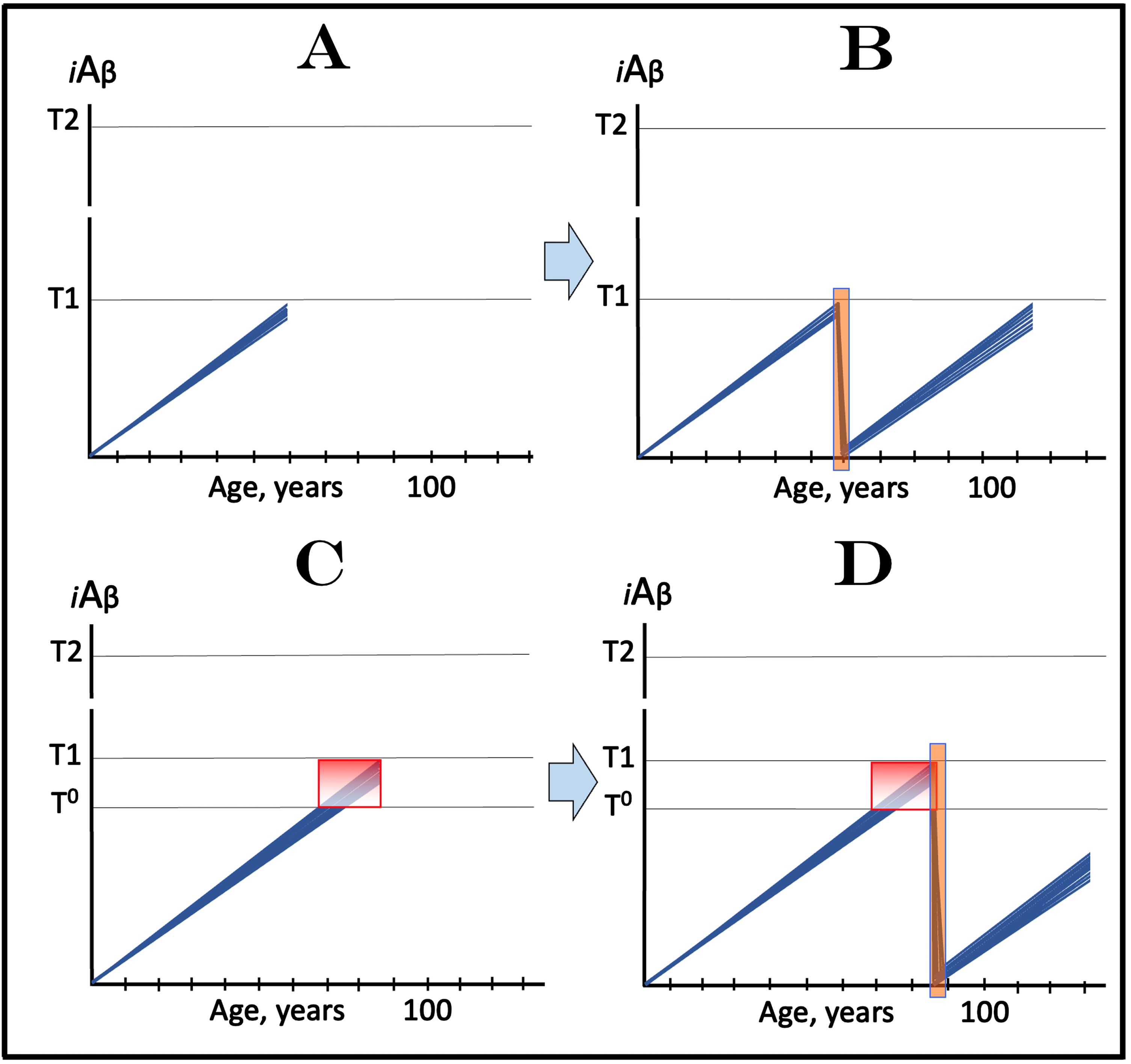 Effect of transient deployment of drugs reducing the influx of AβPP-derived iAβ in prevention of AD and treatment of AACD. Blue lines: Levels of iAβ in individual AD-affected neurons. Threshold T0: iAβ levels that trigger neuronal damage manifesting as AACD. Threshold T1: The level of AβPP-derived iAβ that triggers cellular processes resulting in the activation of the AβPP-independent generation of iAβ. T2 threshold: Levels of iAβ triggering neuronal commitment to apoptosis. Gradient-pink boxes: “AACD Zone”, the continuum of AβPP-derived iAβ levels between T0 and T1 thresholds. Orange fields: The duration of the treatment. Note that the treatment commences prior to the crossing of the T1 threshold and that the drug has no effect over the T1 threshold. Panel A: The initial state of iAβ levels in trial subjects with the low T1 threshold. Panel B: Evolution of the initial state following the transient exposure to a drug targeting the influx of AβPP-derived iAβ and depleting its levels. The accumulation of AβPP-derived iAβ resumes from a low baseline. If the depletion is substantial enough, the levels of AβPP-derived iAβ do not reach the T1 threshold within the remaining lifetime of the individual; it still would be beneficial through delaying the crossing of the T1 threshold and the entry into the second AD stage. Panels C and D: The outcome of the transient administration of a drug targeting the influx of AβPP-derived iAβ and depleting its levels in treatment of AACD. Panel C: The initial state of AβPP-derived iAβ levels in the affected neurons of an AACD patient. They all have crossed the T0 threshold but none have reached the T1 threshold. Panel D: Evolution of the initial state following transient administration of the drug. AβPP-derived iAβ is substantially depleted and its accumulation resumes from a low baseline. Its levels do not reach the T0 threshold within the remaining lifetime of the patient; technically, the patient is cured. Note that any degree of depletion of AβPP-derived iAβ would also be beneficial.