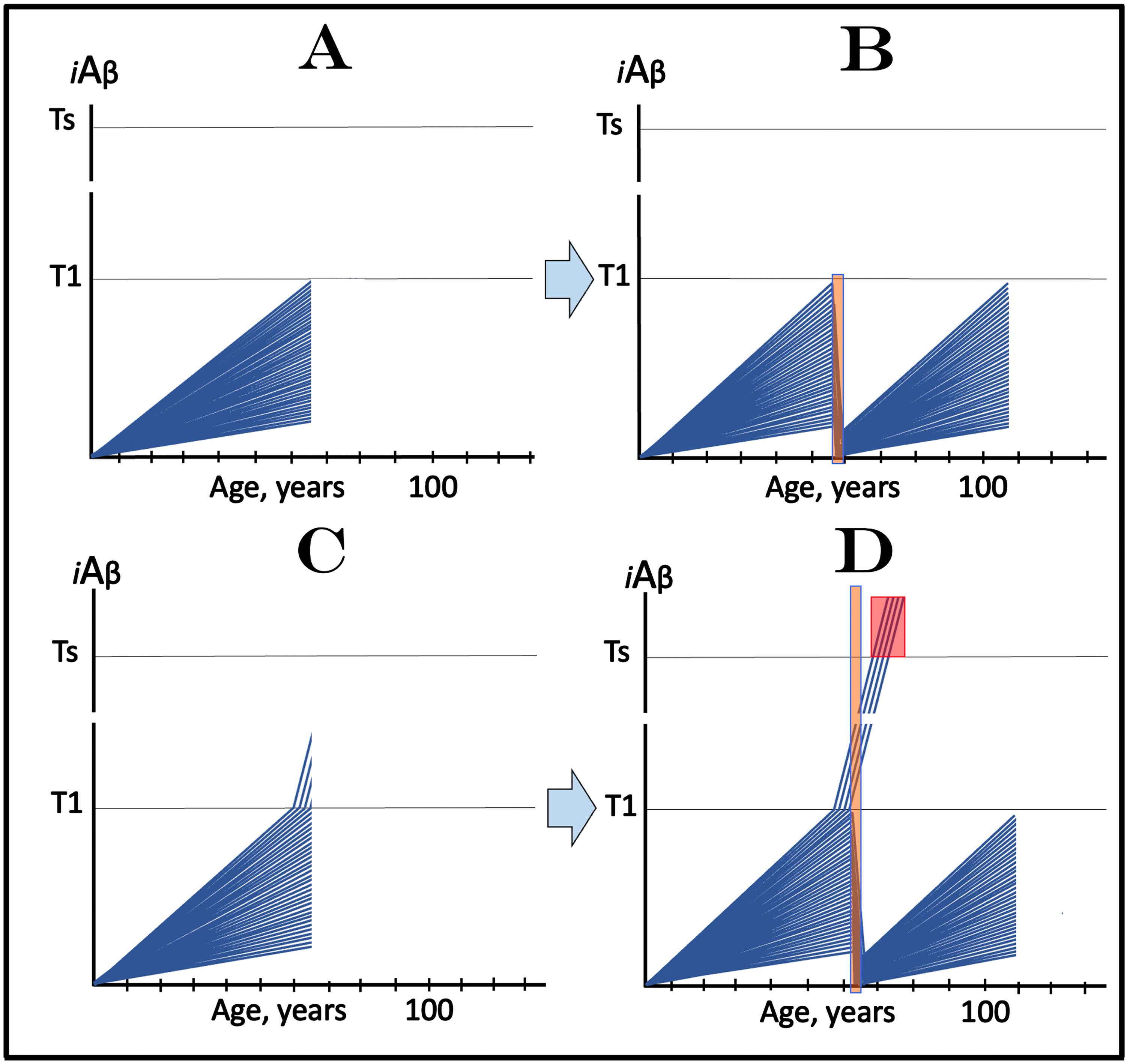 Design and outcomes of clinical trials of transient administration of drugs targeting the influx of AβPP-derived iAβ in prevention of AD. iAβ: Level of intraneuronal Aβ. Blue lines: iAβ levels in individual trial participants. T1 threshold: Levels of iAβ triggering, plausibly via activation of PKR and HRI kinases, elicitation of the ISR and initiation of AβPP-independent production of iAβ. Ts threshold: Levels of iAβ triggering manifestation of AD symptoms. Pink fields: AD Symptomatic Zone. Orange fields: Duration of the treatment. Note that the treatment commences prior to the crossing of the T1 threshold in all participants and that the drug has no effect over the T1 threshold. Panel A: The initial state of iAβ levels in individual participants; note that all are sub-T1. Panel B: Evolution of the initial state following transient exposure to the drug targeting the influx of AβPP-derived iAβ and depleting its levels. iAβ levels are substantially reduced and its accumulation resumes from low baselines. In none of the participants does AβPP-derived iAβ reach the T1 threshold within the remaining portion of his/her lifetime; neither the T1 crossings occur nor AD symptoms manifest. Note that any any degree of transient depletion would also be beneficial. Panel C: The initial state of iAβ levels in individual participants; note that a fraction of subjects is over-T1 yet still asymptomatic. Panel D: Evolution of the initial state following transient exposure to the drug targeting the influx of AβPP-derived iAβ and depleting its levels. With the exception of the initial over-T1 fraction, the levels of AβPP-derived iAβ in individual participants are substantially depleted. Its de novo accumulation resumes from low baselines; its levels do not reach the T1 threshold and AD symptoms do not manifest within the remaining portion of the lifetime of these individuals. The initial over-T1 fraction is unresponsive to the drug targeting the influx of AβPP-derived iAβ. Levels of iAβ, generated predominantly in the AβPP-independent pathway, continue to increase, cross the Ts threshold, and AD symptoms manifest. The outcomes of such trials in the medicated and placebo cohorts would be similar for a substantial duration before diverging.