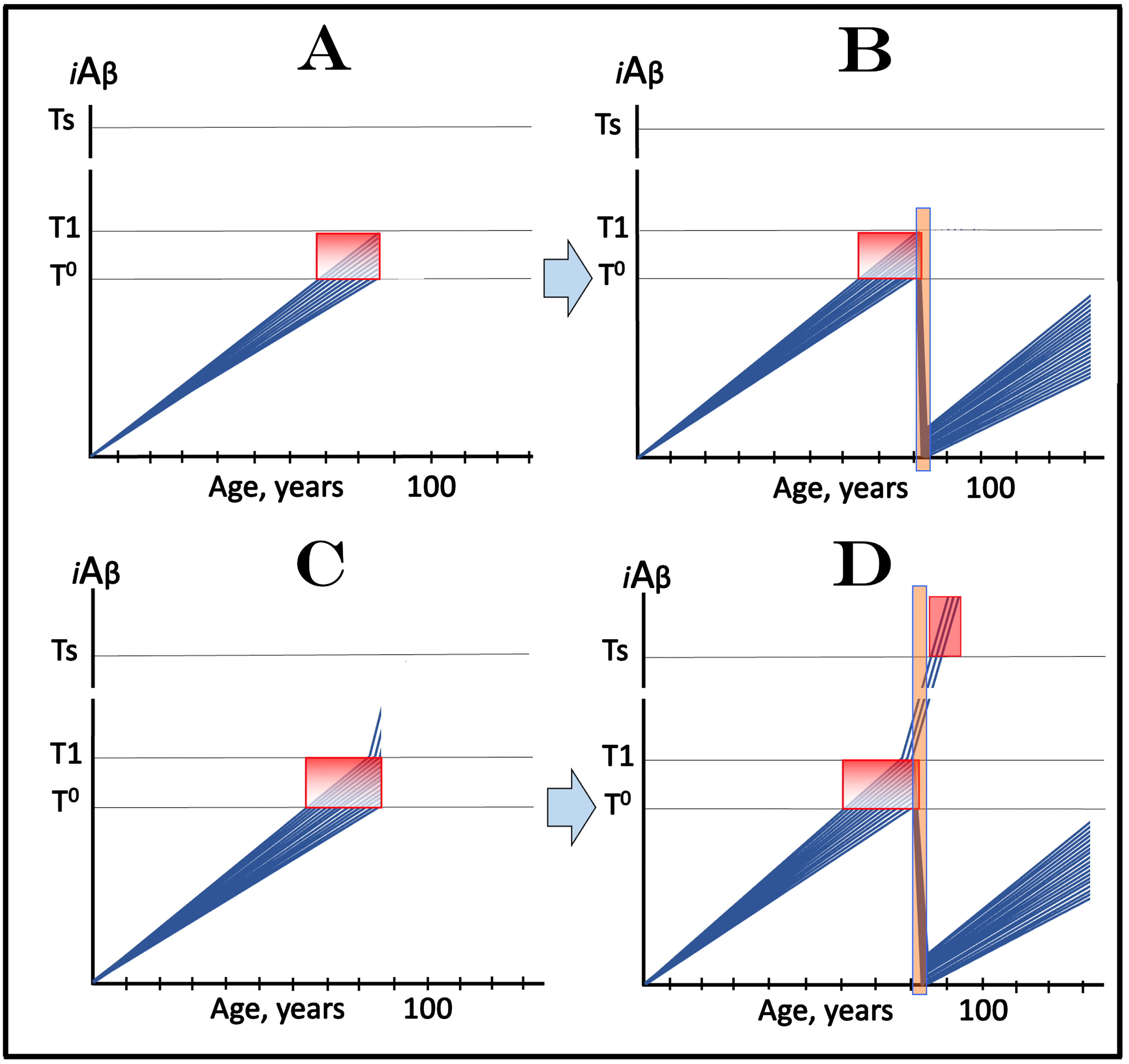 Design and outcomes of clinical trials of transient administration of drugs targeting the influx of AβPP-derived iAβ in treatment of AACD. Blue lines: Levels of iAβ in individual trial participants. Threshold T0: iAβ levels that trigger neuronal damage manifesting as AACD. Threshold T1: The level of AβPP-derived iAβ that triggers cellular processes resulting in the activation of the AβPP-independent generation of iAβ. Ts threshold: Levels of iAβ triggering the manifestation of AD symptoms. Pink fields: AD Symptomatic Zone. Gradient-pink boxes: “AACD Zone”, the continuum of AβPP-derived iAβ levels between T0 and T1 thresholds. Orange fields: The duration of the treatment. Note that the treatment commences prior to the crossing of the T1 threshold and that the drug has no effect over the T1 threshold. Panel A: The initial state of iAβ levels in trial subjects; note that all are sub-T1. Panel B: Evolution of the initial state following transient administration of the drug suppressing the influx of AβPP-derived iAβ and depleting its levels. iAβ accumulation resumes from low baselines and proceed at slow rate. Its levels do not reach the T0 threshold within the remaining portion of the lifetime. No AACD symptoms recur; the patients are technically cured. Panel C: The initial state of iAβ levels in trial subjects including a fraction of subjects that is over-T1 yet asymptomatic for AD. Panel D: Evolution of the initial state following transient deployment of the drug targeting the influx of AβPP-derived iAβ and substantially reducing its levels. With the exception of the initial over-T1 fraction, iAβ is depleted and its accumulation resumes from low baselines. Its levels do not reach the T0 threshold within trial participants’ lifespans and AACD does not recur; these individuals are technically cured. In the initial over-T1 fraction the AβPP-independent iAβ production pathway is insensitive to drugs targeting the influx of AβPP-derived iAβ. These individuals cross the Ts threshold, and AD symptoms manifest. The outcomes of such clinical trial in medicated and placebo cohorts, although eventually diverging, would be similar for a substantial duration. Note that any degree of iAβ depletion below the T0 threshold would be beneficial by delaying the re-entry into the AACD Zone.