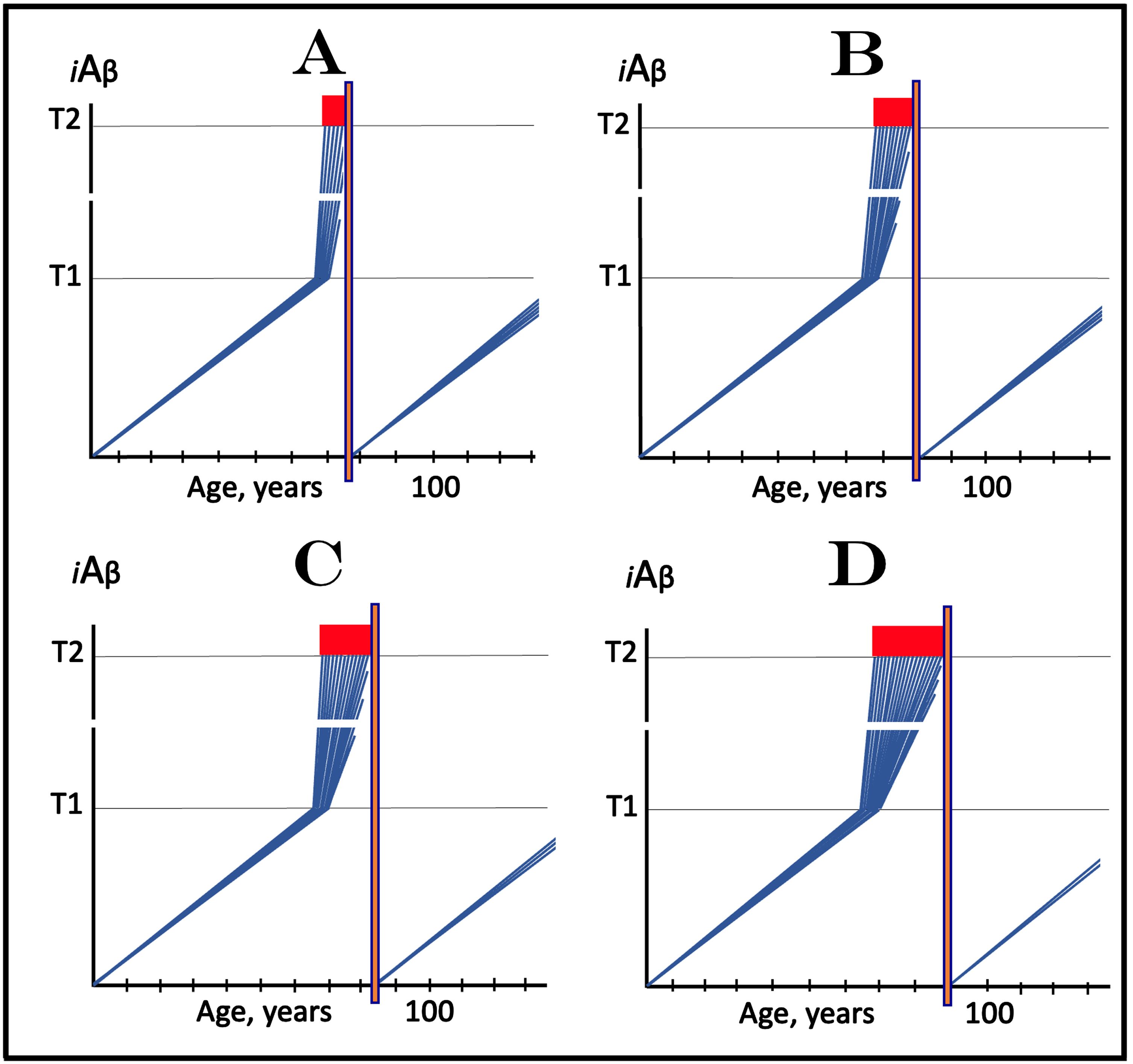 Effect of transient active iAβ depletion via its targeted degradation implemented at various symptomatic stages of AD. Blue lines: Individual affected neurons. iAβ: Level of intraneuronal Aβ. T1 threshold: Levels of iAβ triggering, plausibly via activation of PKR and HRI kinases, elicitation of the ISR and initiation of AβPP-independent production of iAβ. T2 threshold: Levels of iAβ triggering neuronal commitment to apoptosis. Red block: Apoptotic zone. Orange boxes: Active transient iAβ depletion via its targeted degradation. Panel A: The transient iAβ depletion therapy via its targeted degradation is implemented at the early symptomatic stage of AD, when the bulk of the affected neurons are still viable. Following the reset of iAβ levels, their build-up starts de-novo supported only by the AβPP proteolytic pathway. It is anticipated that iAβ levels will not reach the T1 threshold and AD will not recur within the remaining lifetime of an SAD patient. Panels B, C, and D: The transient iAβ depletion via its targeted degradation is implemented at progressively advanced stages of AD. The results are analogous to those depicted in panel A. However, at this AD stages increasing number of affected neurons cross the T2 threshold and commit apoptosis. This leaves progressively smaller number of affected neurons that retained their viability and can be redeemed.