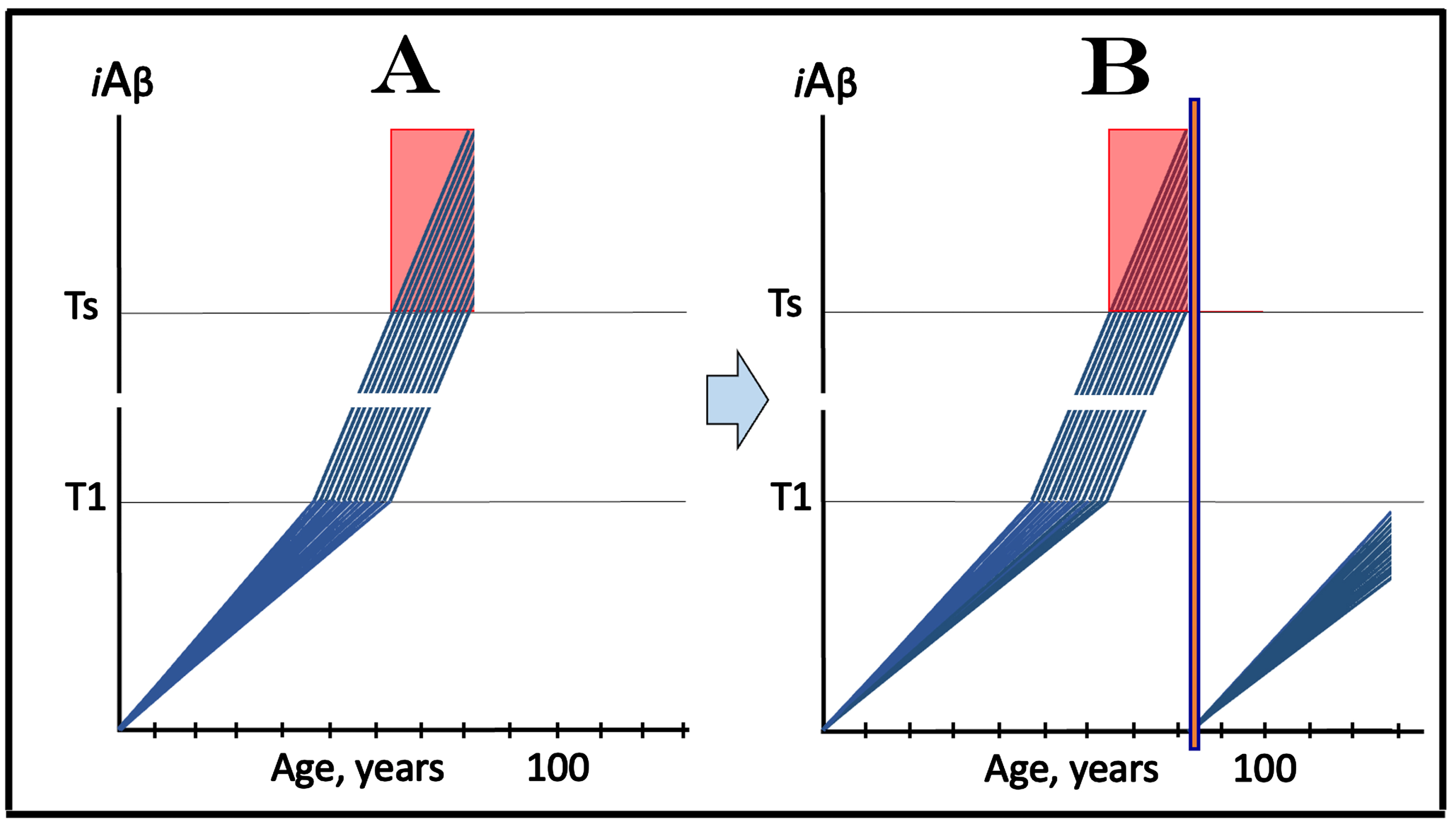 Design and outcome of clinical trial of transiently applied targeted iAβ degradation in treatment of symptomatic AD. iAβ: Level of intraneuronal Aβ. Blue lines: iAβ levels in individual trial participants. T1 threshold: Levels of iAβ triggering, plausibly via activation of PKR and HRI kinases, elicitation of the ISR and initiation of AβPP-independent production of iAβ. Ts threshold: Levels of iAβ triggering manifestation of AD symptoms. Pink fields: AD Symptomatic Zone. Orange box: Duration of the active transient iAβ depletion via its targeted degradation. Panel A: The initial state of the iAβ levels in individual members of selected cohorts; it consists of AD patients presenting a wide spectrum of AD symptoms. The evolution of this initial state in untreated (placebo) cohort (not shown) is trivial: in every patient the disease progresses toward the end-stage. Panel B: Evolution of the initial state following transiently implemented targeted degradation of iAβ. As the result, iAβ levels are completely or nearly completely depleted and operation of the AβPP-independent iAβ production pathway ceases. The de novo accumulation of iAβ, derived now only in the AβPP proteolytic pathway, resumes from a low baseline and proceeds at the slow rate. Its levels would not reach the T1 threshold and the disease would not recur within the remaining lifetime of individual patients. Note that any iAβ depletion below the T1 threshold would be beneficial since it would delay the re-entry into the second AD stage.