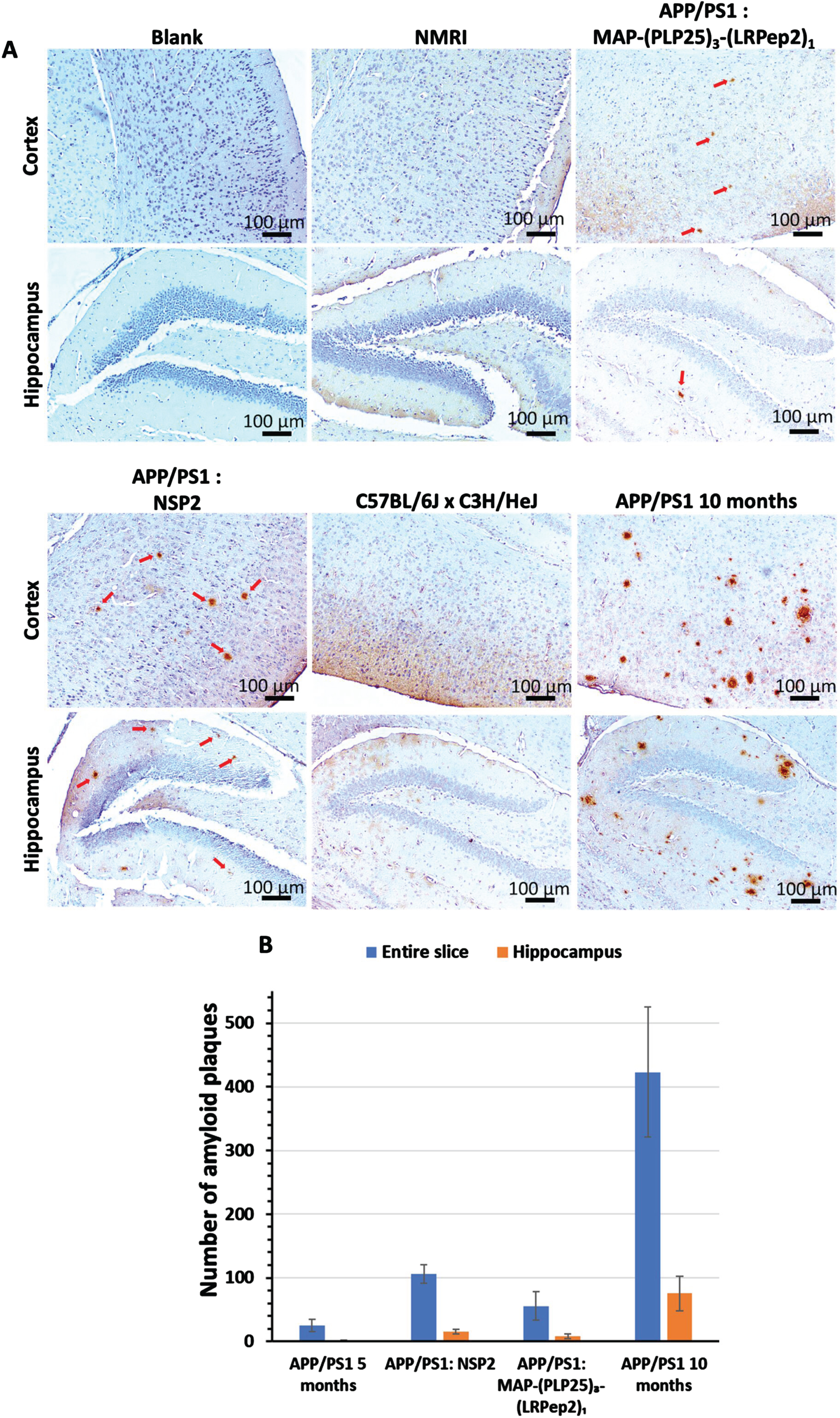 A) AP detected by IHC on healthy NMRI and C57BL/6J x C3H/HeJ as well as APP/PS1 brain slices, treated with MAP-(PLP25)3-(LRPep2)1 or NSP2, or non-treated (APP/PS1 10 months). AP are highlighted by the DAB and appear in brown, as pointed by red arrows. B) Manual counting of AP on APP/PS1 brain slices, on the entire slice or specifically in the hippocampus, for non-treated (5- or 10-month-old) and MAP-(PLP25)3-(LRPep2)1 or NSP2 treated (7-month-old) APP/PS1 mice. Statistics are regrouped in the Supplementary Tables 3 and 4.