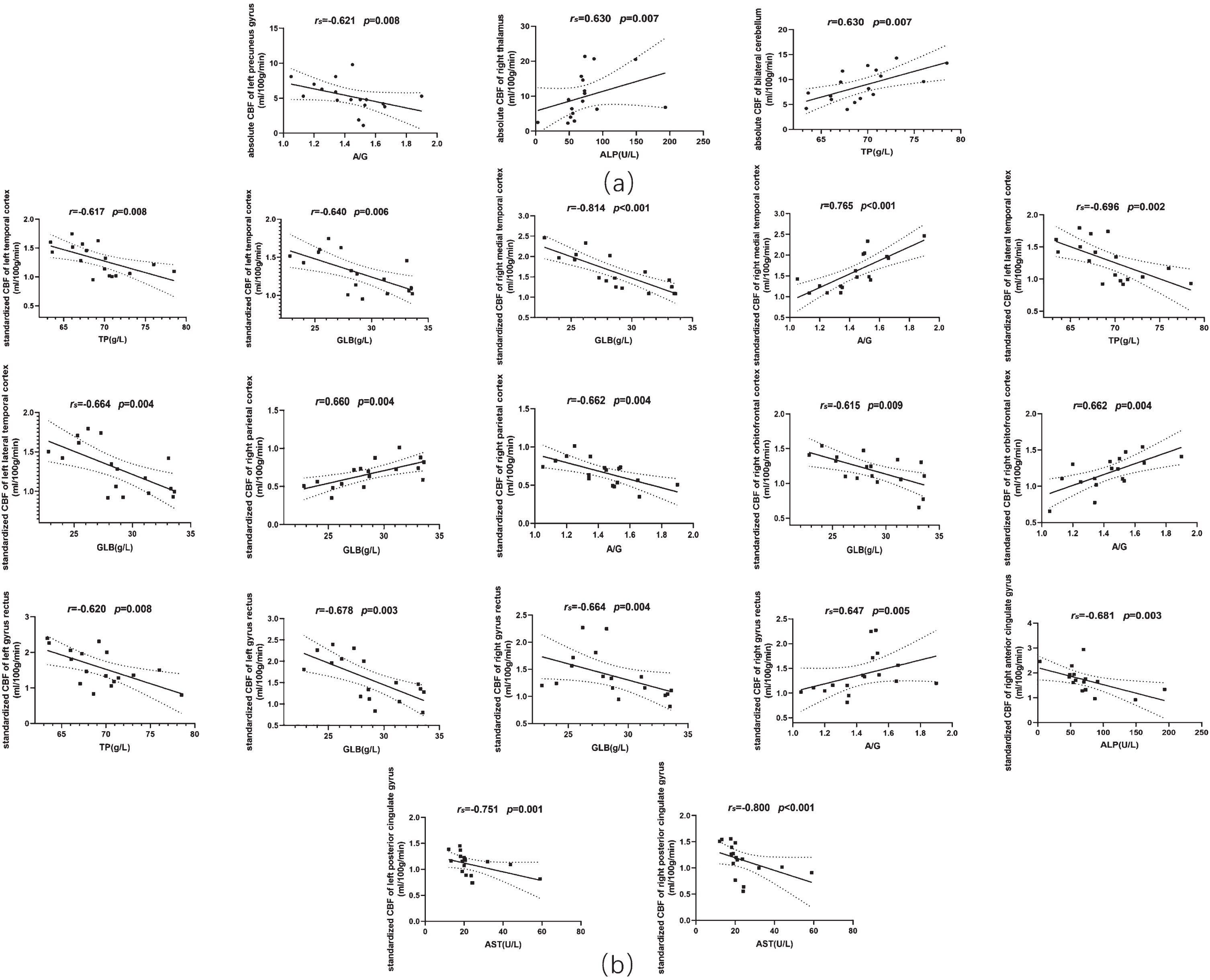 Scatter plots of the correlations between serum liver function markers and regional cerebral blood flow of AD patients. (a) Absolute regional cerebral blood flow. (b) Standardized regional cerebral blood flow. CBF, cerebral blood flow; TP, total protein; GLB, globin; A/G, the ratio of albumin to globin; ALP, alkaline phosphatase; AST, aspartate aminotransferase.