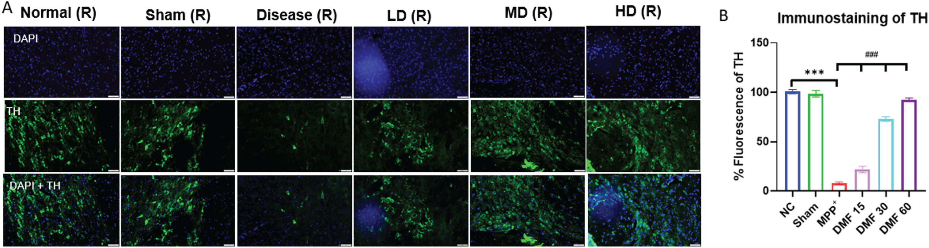 A) Graphical representation of immunofluorescence of TH, scale 50μM. B) % fluorescence of TH in various groups (DF = 12); n = 3. Data represents mean±SEM. The p-values were calculated using a one-way analysis of variance using Bonferroni method (ANOVA). ***p < 0.001 versus NC; # p < 0.05, # # p < 0.01, # # # p < 0.001 versus DC.