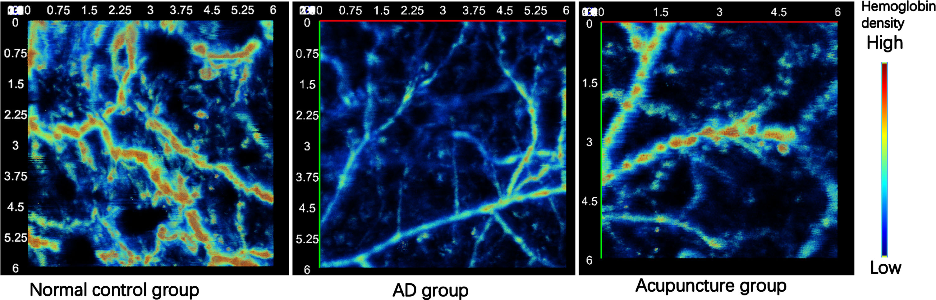 The top view of photoacoustic images of CV12 acupoint region of each group (6 mm×6 mm).