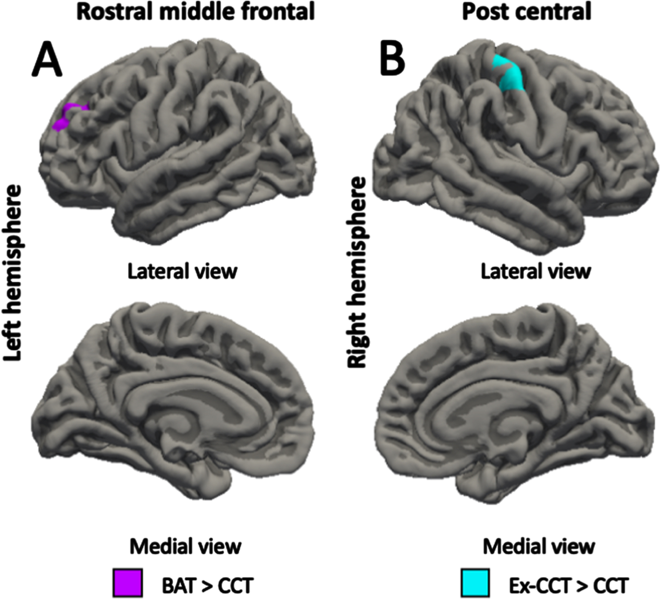 Between-group differences (α< 0.05) in: A) left rostral middle frontal volume; and B) right post central volume, controlling for age, sex, and MoCA.