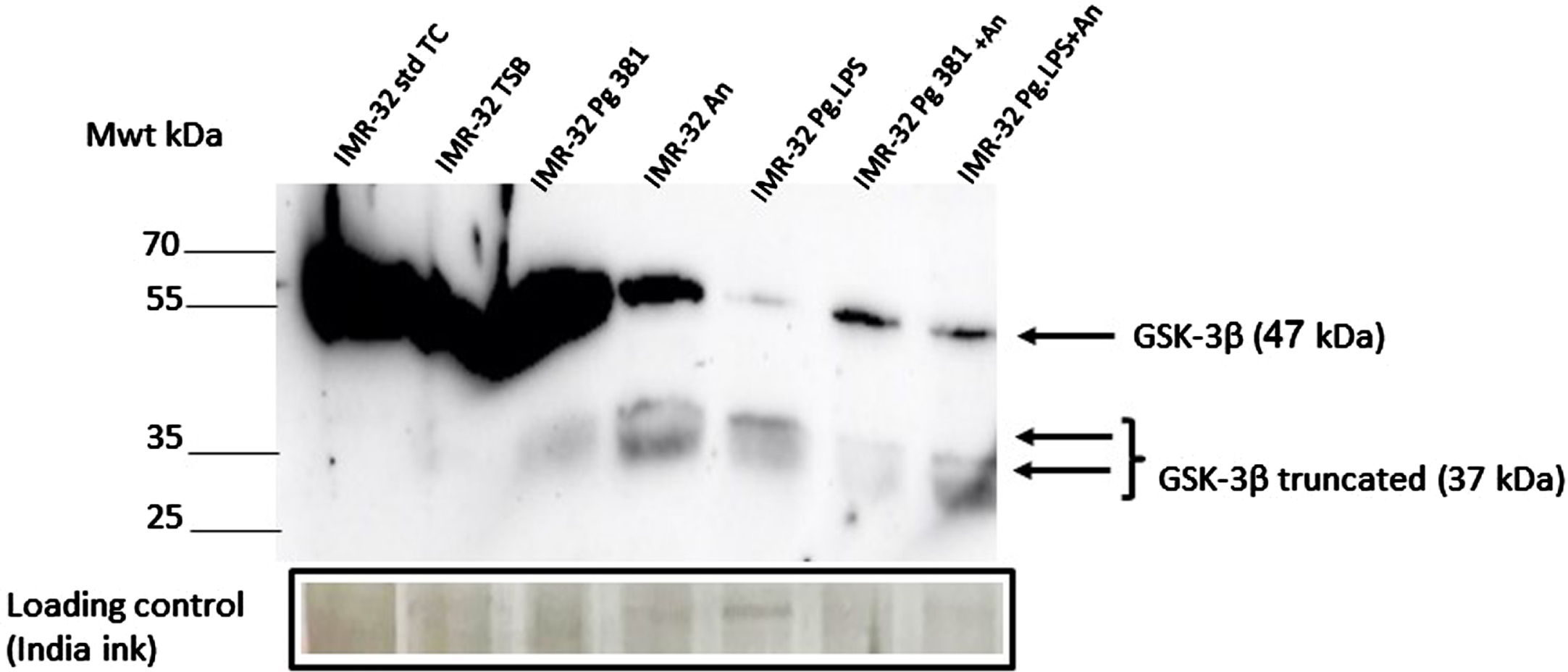 IMR-32 cell lysate western blotting: GSK-3β antibody. Immunoblot of the IMR-32 cell lysate (protein at 10 μg per lane) with anti-GSK-3β antibody. Distinct bands around the 47 kDa molecular weight size corresponding to GSK-3β in lanes with the prefix IMR-32 std TC (std cont) and then IMR-32 TSB (med cont), IMR-32 Pg381, IMR-32 An, IMR-32 Pg.LPS, IMR-32 Pg381+An and IMR-32 Pg.LPS+An. A 37 kDa was observed more clearly in lanes with the prefix IMR-32 Pg381, IMR-32 An, IMR-32 Pg.LPS, IMR-32 Pg381+An and IMR-32 Pg.LPS+An.