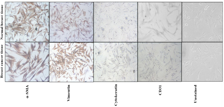 Immunohistochemistry images showing characterization of primary of fibroblasts. α-SMA and vimentin antibodies showed positive staining and cytokeratin and CD31 antibodies showed negative staining on fibroblasts isolated from breast cancer tissue and normal breast tissue. Moreover, α-SMA and vimentin antibodies had strong positive staining on fibroblasts isolated from breast cancer tissue and weaker staining on fibroblasts isolated from normal breast tissue.