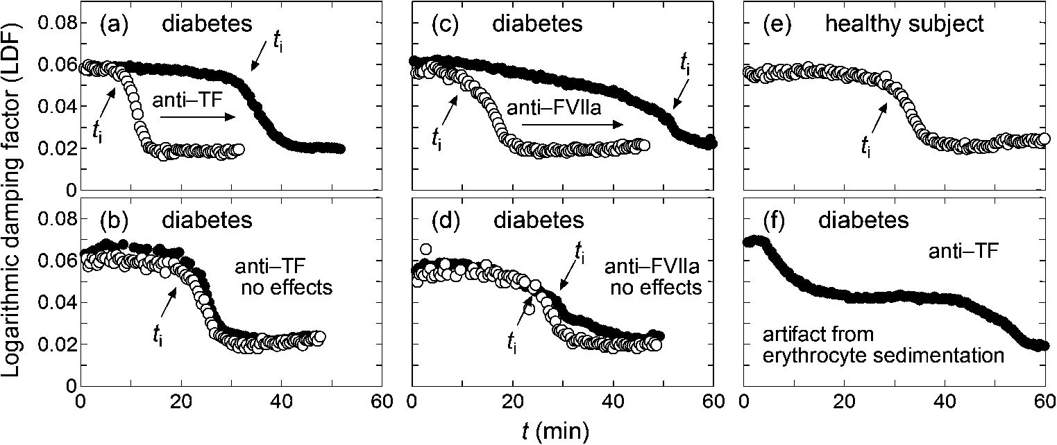 Typical LDF curves, where open and filled circles correspond to the data without and with added anti-TF or anti-FVIIa antibody, respectively, and positions of ti are indicated with arrows. Panels (a) and (b) show the curves for T2DM samples with and without significant effects of added anti-TF antibody, respectively. Panels (c) and (d): same as panels (a) and (b), respectively, but for added anti-FVIIa antibody instead of anti-TF antibody. Panel (e) corresponds to a healthy subject, and panel (f) shows a case where ti cannot be determined because of significant artifact from fast erythrocyte sedimentation.