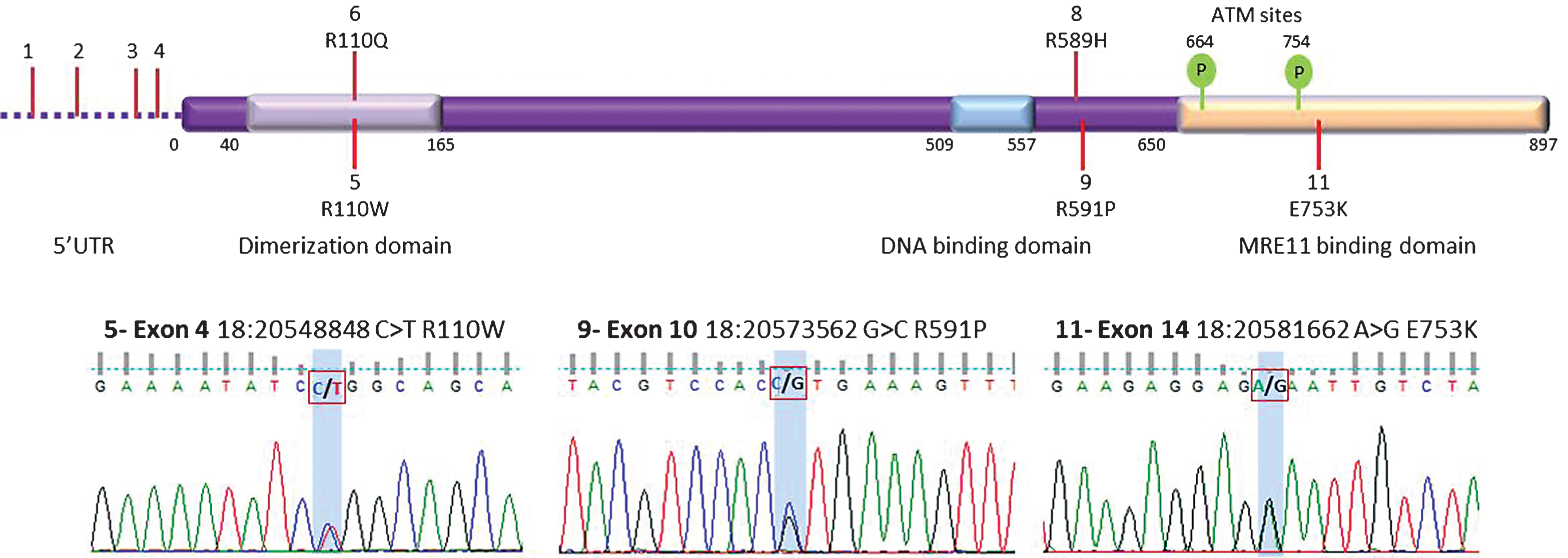 
          Top panel: Protein domains of human CtIP. The N-terminus of human CtIP contains the dimerization domain (amino acids 40–165) [30]. In vitro CtIP shows DNA-binding activity, which could play a role in recruitment to DSBs (amino acids 509–557) [12]. Interaction with the MRN complex has been shown to occur at both the N-terminal region (amino acids 22–45) and the C- terminal region (amino acids 650–897) of CtIP [13, 31]. Signalling via two ATM phosphorylation sites (S664 and S745) are conserved in vertebrates [32]. The location of non-synonymous variants are shown. Known variants 1–4, 6 and 8 are labelled at the top whereas novel variants 5, 9, 11 are below. Synonymous variants 7 and 10 are not shown. See Table 2 for variant identities. Bottom Panel: Sanger sequencing traces for validation of three novel variants; 5, 9 and 11.
        
