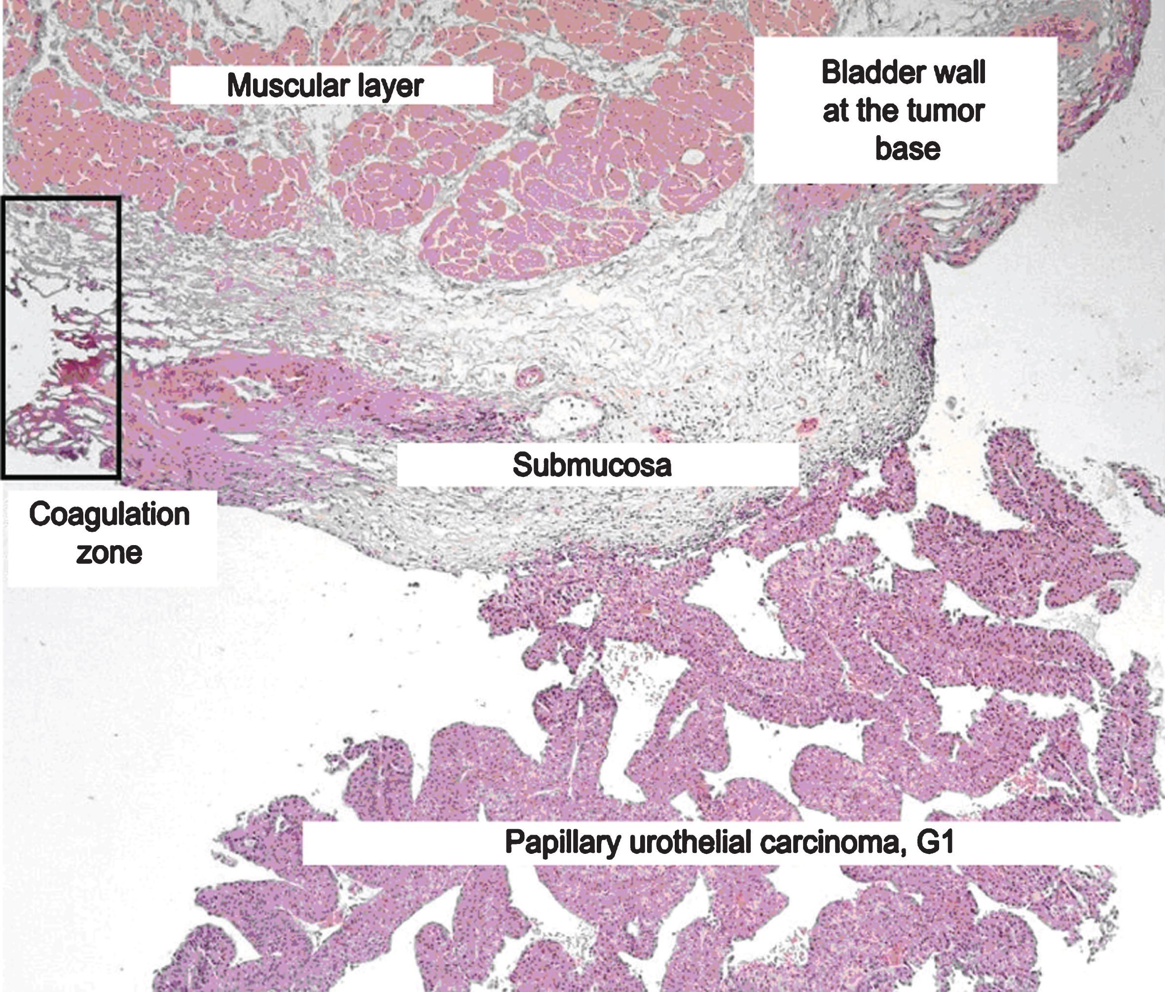 Histology slide.