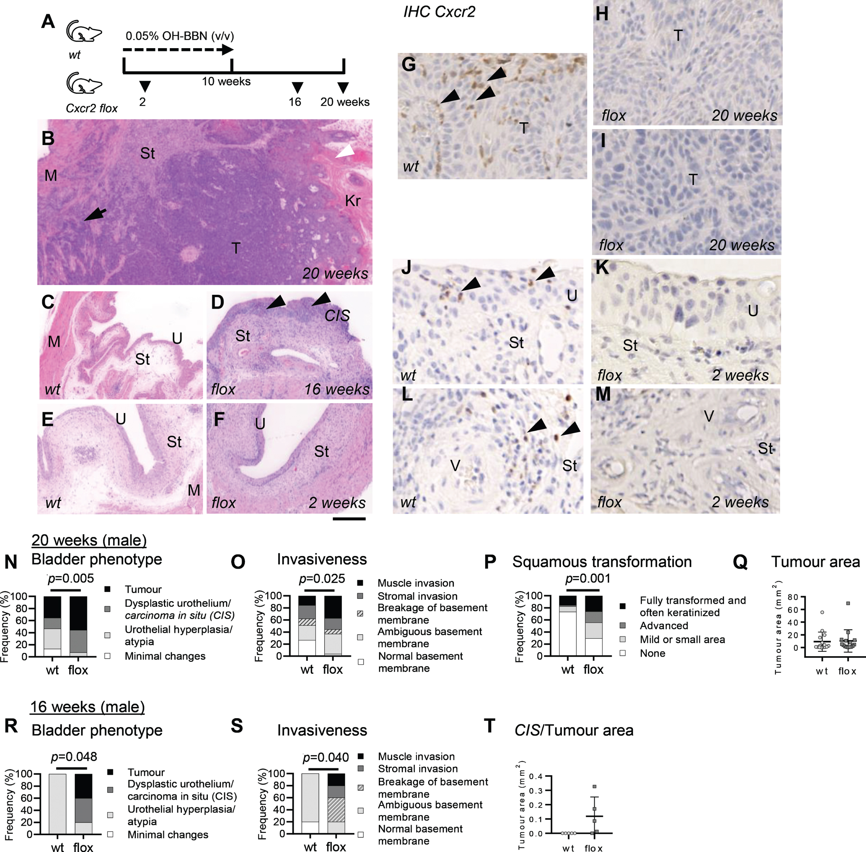 Bladder tumour phenotype of LysMCre Cxcr2flox/flox (Cxcr2 flox) mice. (A) Mice were given tobacco carcinogen 0.05% (v/v) OH-BBN in drinking water for 10 weeks, and bladder tissues were examined at 2, 16 and 20 weeks from the start of the carcinogen treatment. (B) An example of a bladder tumour developed at 20 weeks from the start of the carcinogen treatment in a Cxcr2 flox animal, with an invasion to the muscle (arrow) and keratinization (Kr). Representative images of wildtype (C, E) and Cxcr2 flox (D, F) bladders at 16 weeks (C, D), and 2 weeks (E, F). Enhanced tumour pathogenesis of the urothelium, such as carcinoma in situ-like lesions (arrowheads) was observed in Cxcr2 flox bladders at 16 weeks (D). At 2 weeks, the differences between wildtype and Cxcr2 flox bladders were not evident. IHC staining showed infiltrating Cxcr2+ myeloid cells in tumours at 20 weeks (G), the urothelium (J) and around the blood vessels in the bladder stroma (L) at 2 weeks in wildtype mice (arrows in G, J, L). In contrast, the staining was absent in Cxcr2 flox tumours (H, I) and in the bladder at 2 weeks’ time point (K, M). IHC staining was performed in at least n = 3 samples in each genotype. Annotations in B-M are; CIS, carcinoma in situ; Kr, keratinization; M, muscle, St, stroma; T, tumour; U, urothelium; V, blood vessel. The scale bar represents 500μm in B, 250μm in C-F, 30μm in G-M. For evaluation of the bladder and tumour phenotype, the scoring criteria from our previous study [35] were refined to optimally capture the phenotype of OH-BBN treated mice under our protocol. The “bladder phenotype” defines the overall state of the urothelial tumorigenesis and progression. The “invasiveness” describes the state of the basement membrane and invasion of tumour cells, while the “squamous transformation” describes the squamous appearance of cells and keratinization in the urothelium or in the tumour. The criterium “minimal changes” of the bladder phenotype was established to indicate the baseline appearance of the urothelium treated with OH-BBN observed [35]. One representative H&E section was scored per animal. The bladders usually showed a mixed phenotype of all criteria. The worst score was used. Bladder phenotype (N, R), invasiveness (O, S) and squamous transformation (P) are expressed as a frequency of observations (%) comparing wildtype (wt, n = 45) and Cxcr2 flox (flox, n = 27) male mice at 20 weeks (N-P) and at 16 weeks (n = 5 per cohort) (R, S). Incidents of tumour in N were presented by numbers in Table 1. The tumour area was measured by QuPath in a representative section per mouse at 20 weeks (n = 15 per cohort) (Q) and carcinoma in situ (CIS) and tumour areas at 16 weeks (n = 5 per cohort) (T). The means with standard deviation are shown in bars (Q, T). Observations in male mice are presented (N-T). The p-values (Mann-Whitney test) are indicated where significant (p < 0.05).