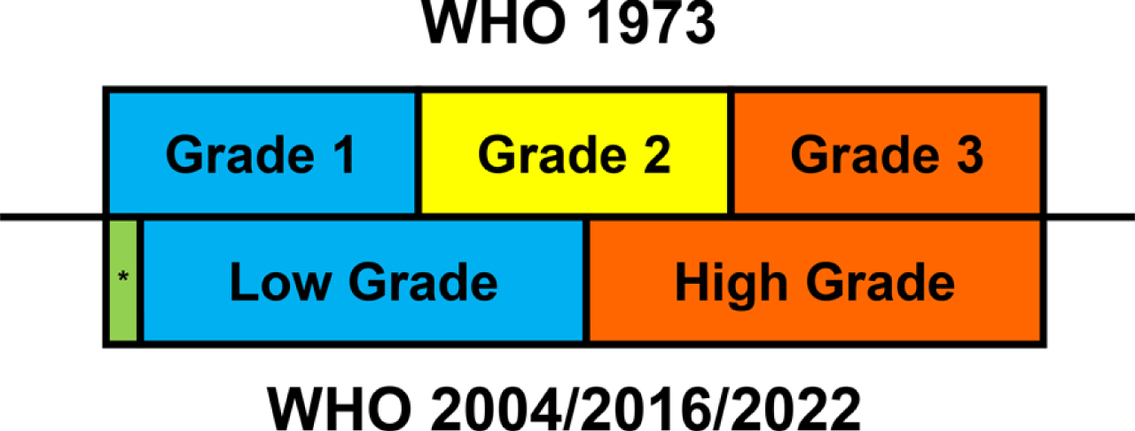 Correlation among different WHO grading systems of papillary urothelial carcinoma. The 1973 system uses a 3-tier numeric grading, and the 2004/2016/2022 system uses a binary grading. While low grade tumors include most of grade 1 tumors and grade 2 tumors with relatively less atypia, high grade tumors include all grade 3 tumors and grade 2 tumors with more atypia. * Papillary urothelial neoplasm of low malignant potential is a separate entity from papillary UC and corresponds to the very low end of grade 1 tumors.