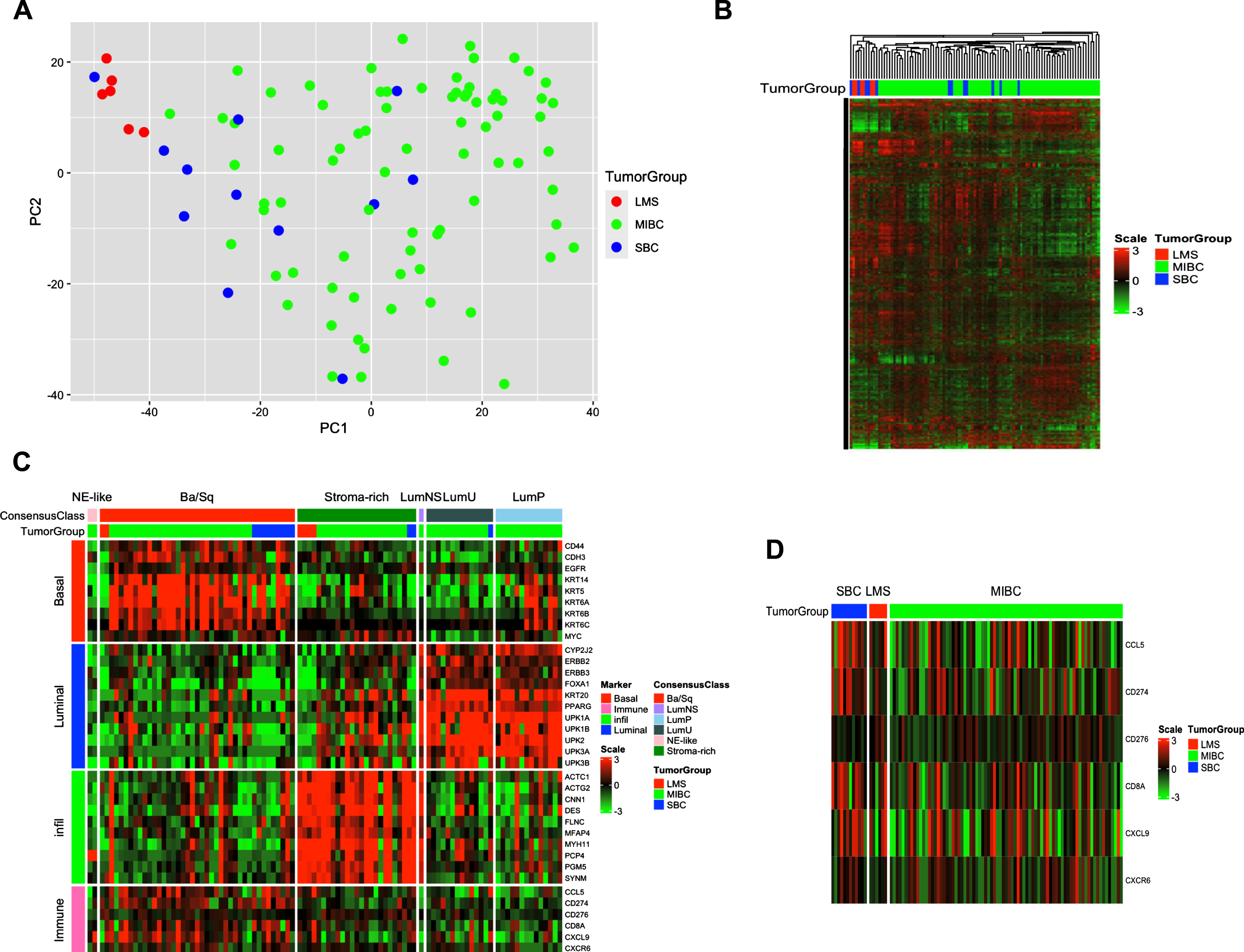 Whole Transcriptome Analysis of SBC compared to MIBC and leiomyosarcoma. A. Principal component analysis of the SBC (n = 12), MIBC (n = 79), and leiomyosarcoma (n = 6) sample RNA sequencing data. Green = MIBC, Blue = SBC, Red = leiomyosarcoma. B. Unsupervised cluster analysis of gene expression among the top 5000 most variable genes of the samples in (A.). Green = MIBC, Blue = SBC, and Red = leiomyosarcoma. Red denotes higher expression, and green denotes lower expression. C. Application of The Consensus Molecular Classifier Gene Expression Signatures of Muscle-Invasive Bladder Cancer to SBC (n = 12), MIBC (n = 79), and leiomyosarcoma (n = 6) sample RNA sequencing data. Green = MIBC, Blue = SBC, Red = leiomyosarcoma. D. Gene Expression Signatures of Key Anti-tumor Immune Response, Inflammation, and T-cell Infiltration Genes in SBC (n = 12), MIBC (n = 79), and leiomyosarcoma (n = 6) sample RNA sequencing data. Green = MIBC, Blue = SBC, Red = leiomyosarcoma using the same color schema as in (B.). SBC = sarcomatoid bladder cancer; MIBC = muscle-invasive bladder cancer.