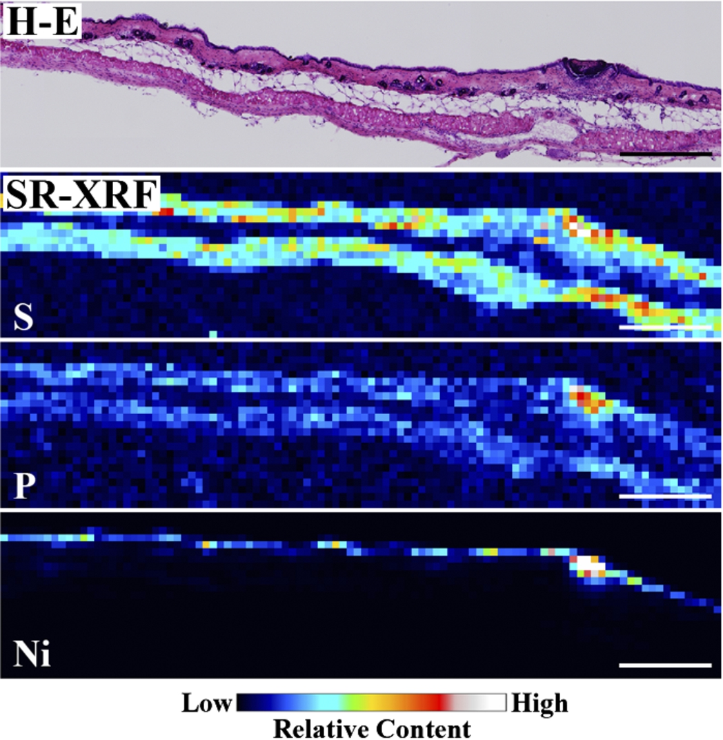 Histopathological (H–E stained) and elemental distribution images, as obtained by SR-XRF, of mouse skin following Ni allergy patch application for 24 h (cross section, bar = 500 µm). (Colors are visible in the online version of the article; http://dx.doi.org/10.3233/BME-151543.) (Colors are visible in the online version of the article; http://dx.doi.org/10.3233/BME-151543.)