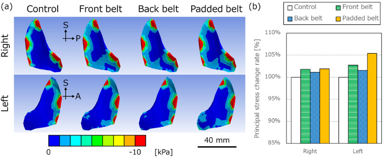 (a) Minimum principal stress distribution of right (1st line) and left (2nd line) sacroiliac joint cartilage shown from left and right, respectively. The red area shows the tensile area, and the tensile area decreased by pelvic belts. The scale bar: 40 mm. S: superior, A: anterior, P: posterior. (b) The comparison of mean minimum principal stress rates for the control condition. Right and left mean right and left sacroiliac joints, respectively.