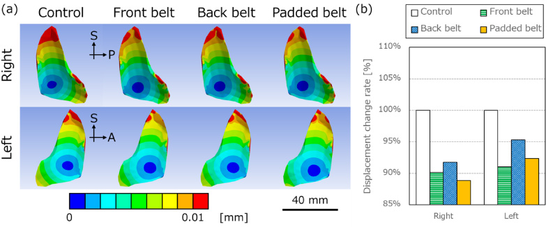 (a) Resultant displacement distribution of right (1st line) and left (2nd line) sacroiliac joint cartilage shown from left and right, respectively. The very low displacement area (blue area) increased with pelvic belts. The scale bar: 40 mm. (b) The comparison of mean resultant displacement rates for the control. Right and left mean right and left sacroiliac joints, respectively.