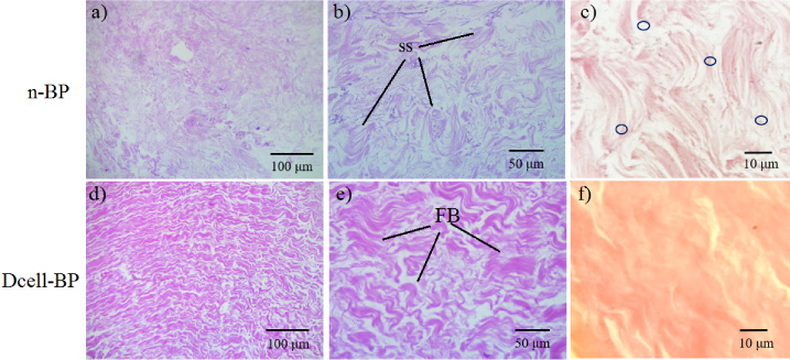 Histological analysis of the decellularization process. Samples were processed with hematoxylin and eosin staining. Native bovine pericardium, n-BP (a–c) and the bovine pericardium decellularized, Dcell-BP (d–f). SS indicates CLG arranged in a swirling structure; the circles show cell nucleus. FB indicates CLG in bundles (eosinophil material arranged in parallel bands with each other).