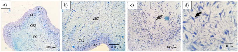 Histological examination of dental pulp. (a) It can be distinguished 4 zones of dental pulp: OZ = Odontoblastic Zone, CFZ = Cell Free Zone, CRZ = Cell Rich Zone and PC = Pulp core. (b) Can observed odontoblasts (black arrow). (c) In cell zone can observe endothelial cells. (d) Fusiform aspect of dental pulp cells.