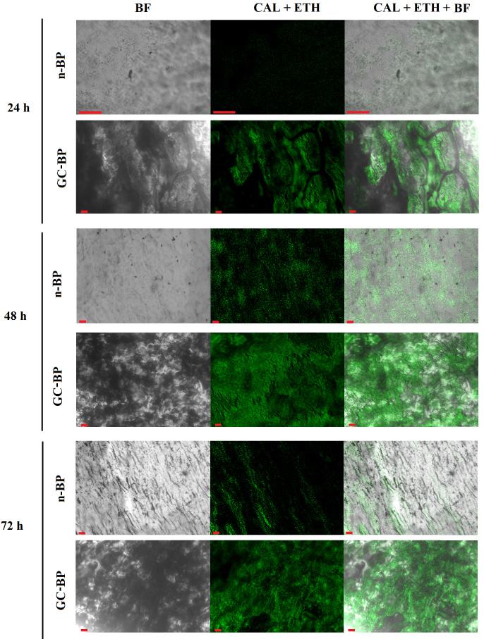 Live/Dead assay of DPSCs by fluorescence. Confocal micrographs of DPSCs exposed to native (n-BP) and decellularized and crosslinked BP (GC-BP). CAL, calcein, EthD, ethidium, BF, bright field. Red scale bar 50 μm.