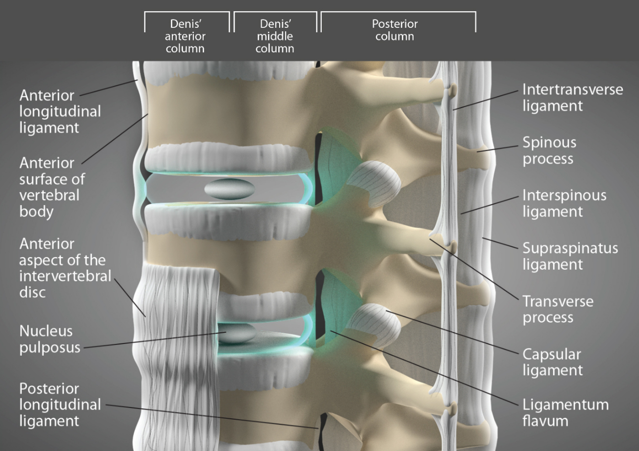 The Denis model of the lumbar spine divides the spine into 3 columns.