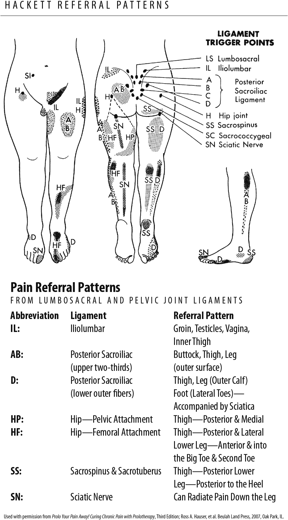 Ligament referral pain patterns from structures in the lower back and hip.