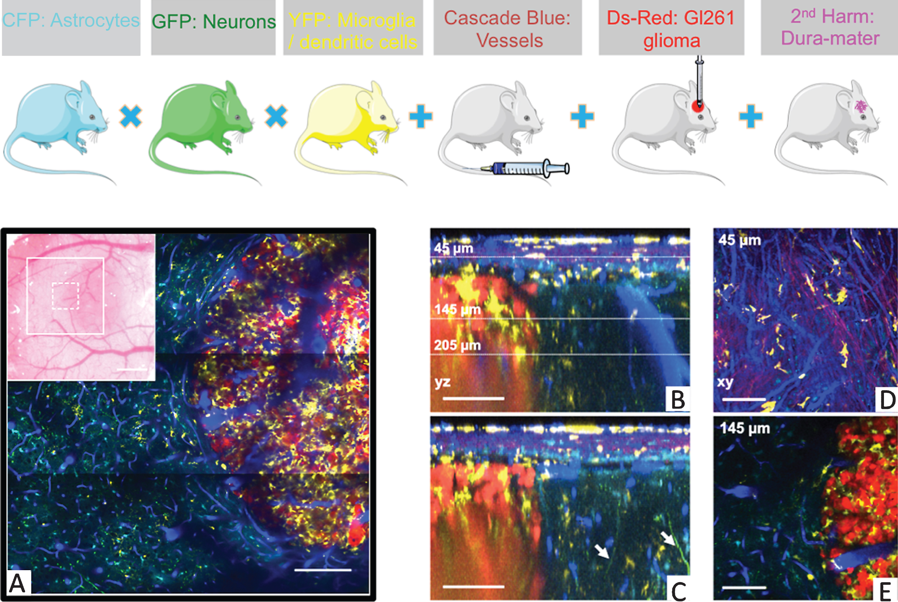 Five-color intravital two-photon imaging of glioblastoma tumor and its dynamic environment. Upper panel: fluorescent mice. (A) 5-colors tile scan (3 × 3 images) of the GBM and its microenvironment; inset: macroscopic image of the cranial window with the area covered by the tile scan (large white square) and the area covered by a single plane acquisition (small dotted square). (B) Orthogonal reconstructions obtained from a stack acquired from 0 to 300 μm below the glass coverslip with a z-step of 3 μm. Each YZ image shows the maximum intensity projection over 10 microns along the X axis. (Note in B the vertical orientation of major brain vessels; dotted lines: the levels of xy-sections. (C) Apical dendrites GFP positive of neurons are visible (arrows). Also note the SHG signal (magenta) corresponding to the collagen fibers at the level of the dura-mater. CD11c-positive cells (yellow) have invaded the tumor but not surrounding healthy tissues. (D, E) xy-sections taken at 45 μm and 145 μm below the glass coverslip. Colors: blue: vasculature, cyan: astrocytes, green: neurons, yellow: CD11c-positive cells, magenta: SHG signal (dura-mater), red: tumor cells. Scale bars: 100 μm (adapted from Ref.18).
