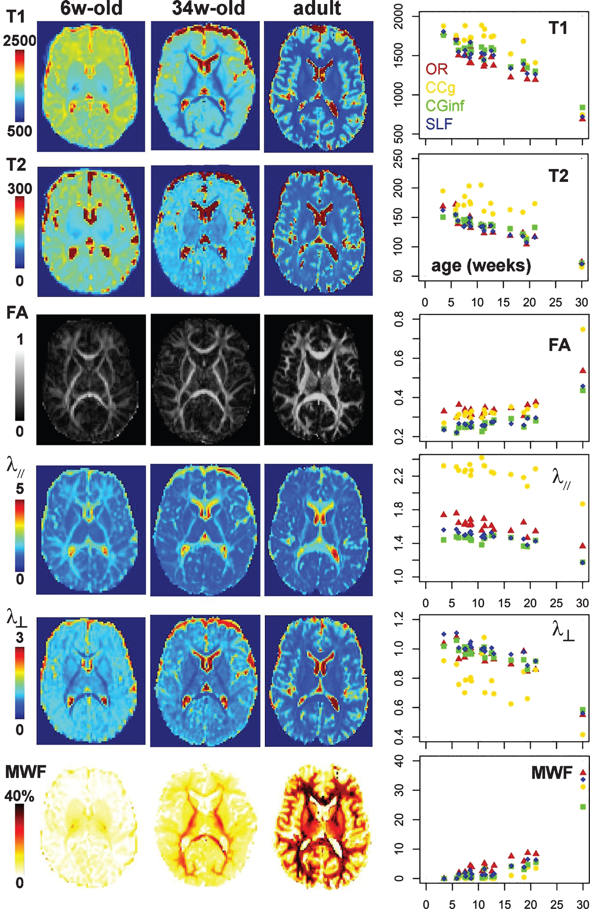 Asynchrony and spatial heterogeneity of maturation quantified with MRI parameters. Left rows: Maps of MRI parameters (a: T1, b: T2, c: DTI fractional anisotropy FA, d: longitudinal diffusivity λ//, e: transverse diffusivity λ⊥, f: myelin water fraction MWF) in a 6- and a 34-week-old infant, and a young adult. Right row: Age-related changes in MRI parameters over a group of 17 infants aged between 3 and 21 weeks, for the four white matter bundles shown in Fig. 1 (projection: optic radiations OR, commissural: genu of the corpus callosum CCg, limbic: inferior branch of the cingulum CGinf, association: superior longitudinal fasciculus SLF), suggesting different maturational calendar across bundles. The median values computed over a group of 13 young adults are also indicated on the right of the plots (arbitrary age of 30w). There is a high variability across bundles also at the mature stage particularly in terms of FA, λ// and MWF. For quantification on other bundles, one can refer to [40, 99].
