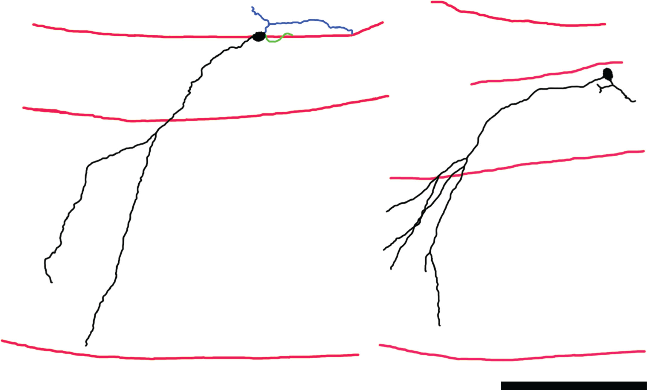 Neurolucida reconstructions of Thy1-GFP-expressing newborn hippocampal granule cells from mice rendered epileptic using the pilocarpine status epilepticus model. Dendrites and somas are shown in black, axons in blue and basal dendrites in green. Red lines denote the hilar—granule cell body layer border, the granule cell body layer—molecular layer border, and the hippocampal fissure, from top to bottom, respectively. The primary dendrites of these granule cells project obliquely into the molecular layer, rather than directly – as is typical for this cell type. The abnormality gives the cells a “windswept” appearance. Scale bar = 100μm. Portions of this image are reprinted from Santos et al. [55].