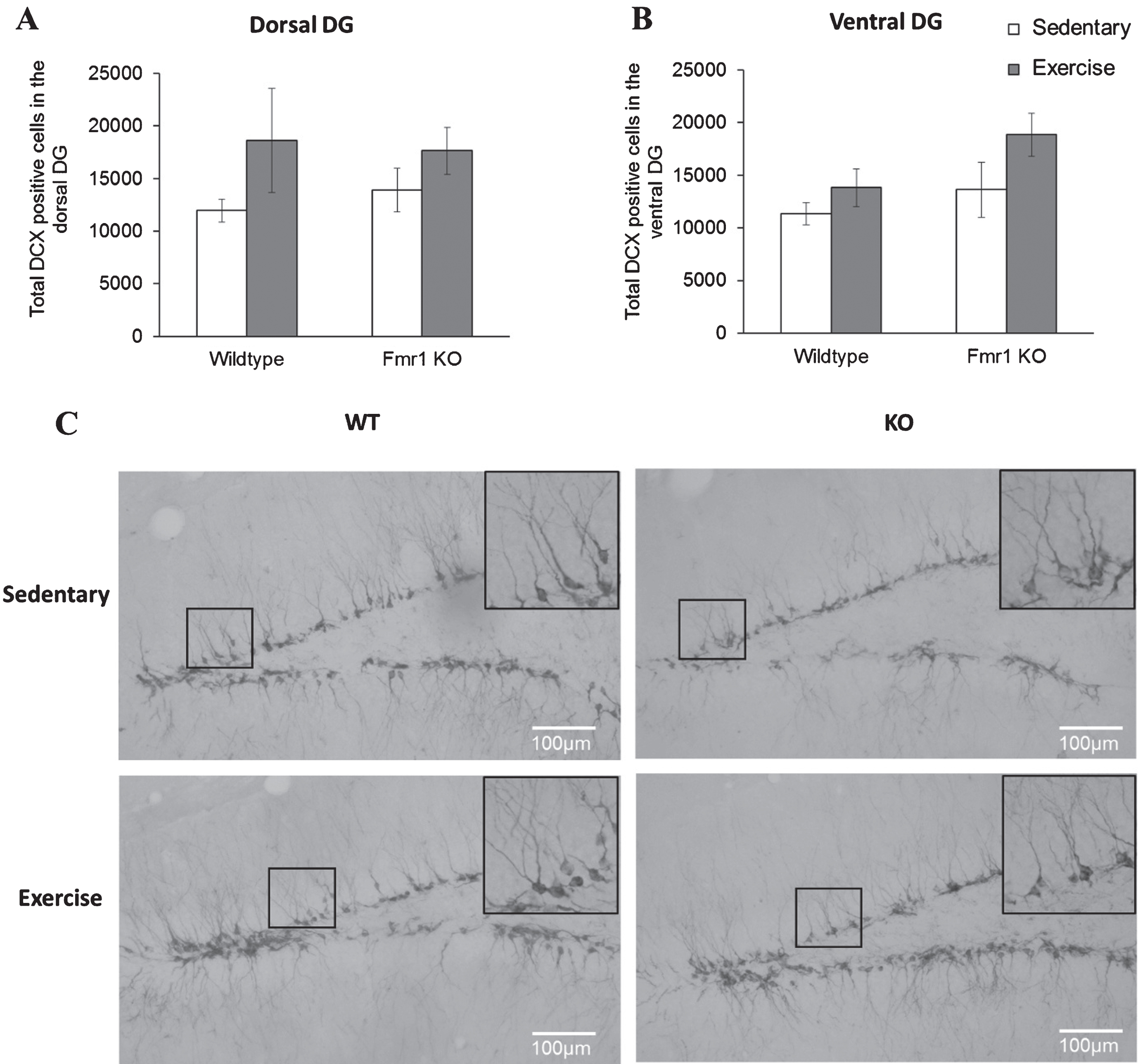 Long-term running did not influence the number of newborn neurons in Fmr1 KO mice. (A, B) The number or DCX positive neurons remained unaltered by long-tern running in both dorsal and ventral hippocampus (*p < 0.05). (C) Representative images of DCX-positive cells. Scale bar: 100μm.