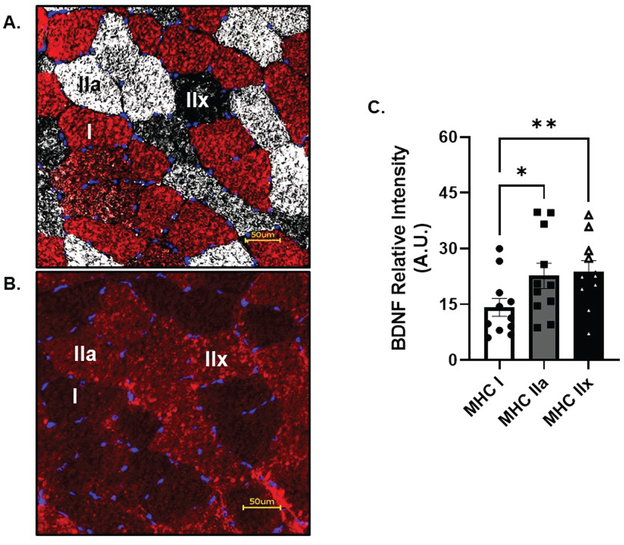 Skeletal Muscle Fiber Type Analysis of BDNF. A) Representative image of skeletal muscle fiber type and B) BDNF. C) BDNF relative intensity per fiber type. Red fibers = MHC I, white fibers = MHC IIa and black fibers = MHC IIx All data are represented as mean±SEM. n = 11 (7M/4F) for MHC I and IIa, n = 10 (6M/4F) for MHC IIx. *p < 0.05, **p < 0.01.