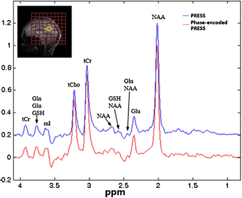 In vivo spectra acquired from a VOI in the occipital lobe using both the standard PRESS (blue) and the PE-PRESS (red) pulse sequence. The sagittal T1-weighted image on top of spectra shows that the VOI location (yellow square) is chosen to be away from the skull. Without lipid contamination, both sequence yield similar spectrum.