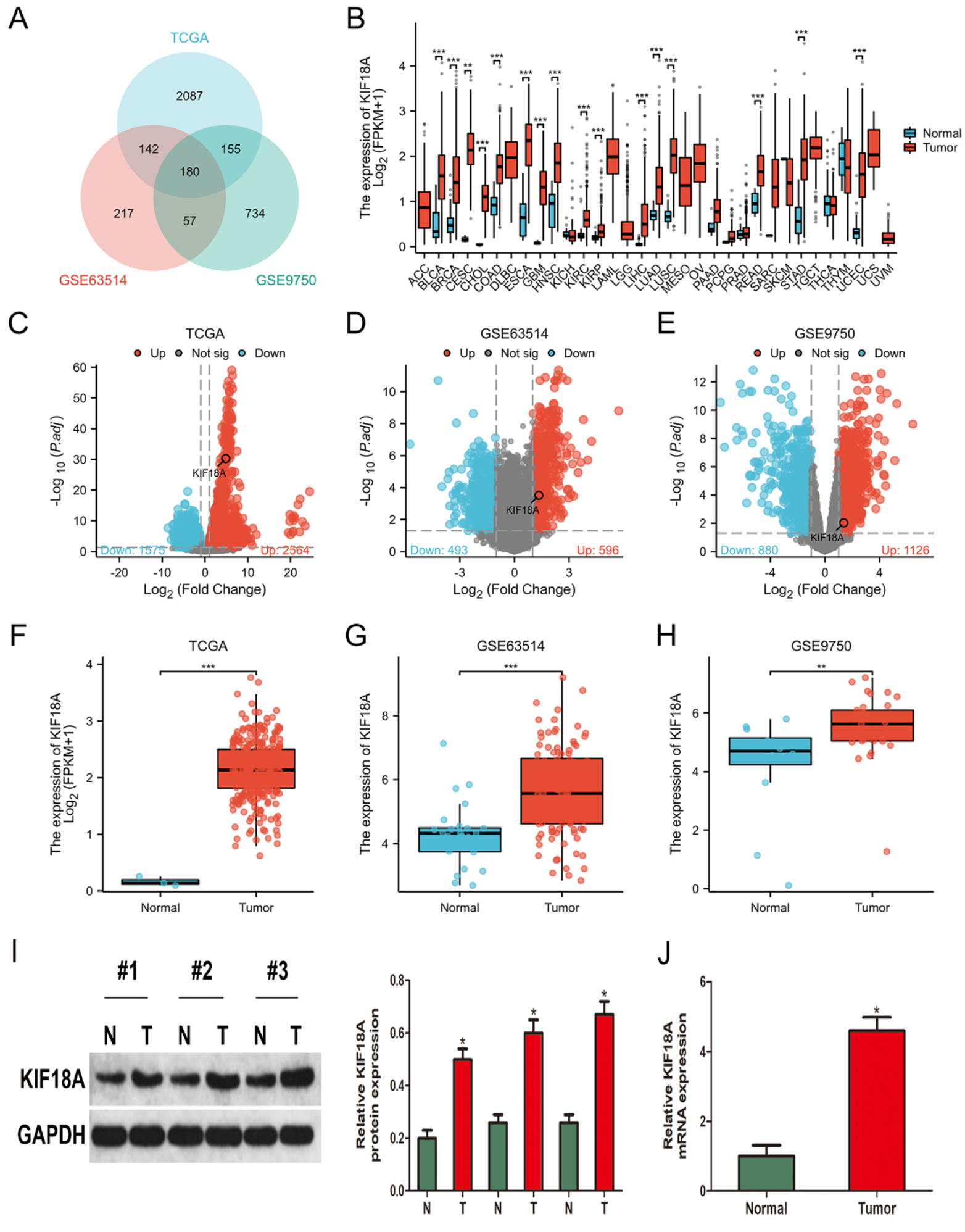 The KIF18A expression is significantly upregulated in cervical cancer. (A) Venn diagram illustrating the overlapping DEGs obtained from TCGA-CESC, GSE63514, and GSE9750 datasets. (B) The expression of KIF18A was analyzed across multiple cancer types using data obtained from the TCGA. (C–E) Volcano plots were employed to identify DEGs in the TCGA-CESC, GSE63514, and GSE9750 datasets, respectively. (F–H) The KIF18A expression level exhibited a significant rise in TCGA-CESC, GSE63514, and GSE9750 datasets. (I, J) KIF18A expression levels were assessed and quantified in CESC samples and their corresponding normal tissues using Western blot analysis and qRT-PCR. * p < 0.05; **p < 0.01; ***p < 0.001. 