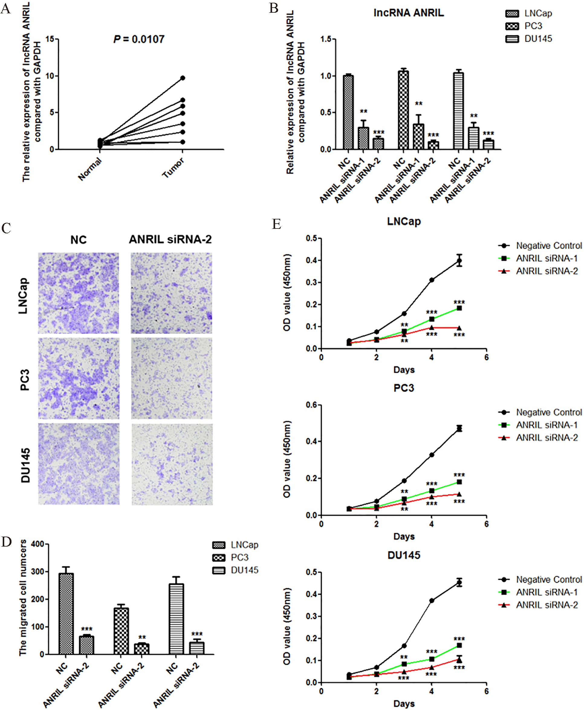 lncRNA ANRIL is overexpressed in prostate cancer, and knockdown of lncRNA ANRIL inhibits the proliferation and migration of prostate cancer cells. A. lncRNA ANRIL was overexpressed in prostate cancer detected by Real-time PCR assay (n= 8). B. Knockdown of ANRIL in LNCap, PC3 and DU145 cells was detected by Real-time PCR. C and D. Effect of ANRIL siRNA on the migration of LNCap, PC3 and DU145 cells. The migration of cells was measured by Transwell migration assay, and statistical analysis was done using Student’s test. E. Effect of ANRIL siRNAs on the proliferation of LNCap, PC3 and DU145 cells. The viability of cells was measured by Cell Counting Kit-8, and statistical analysis was done using Student’s test. *, P< 0.05; **, P< 0.01; *⁣**, P< 0.001.