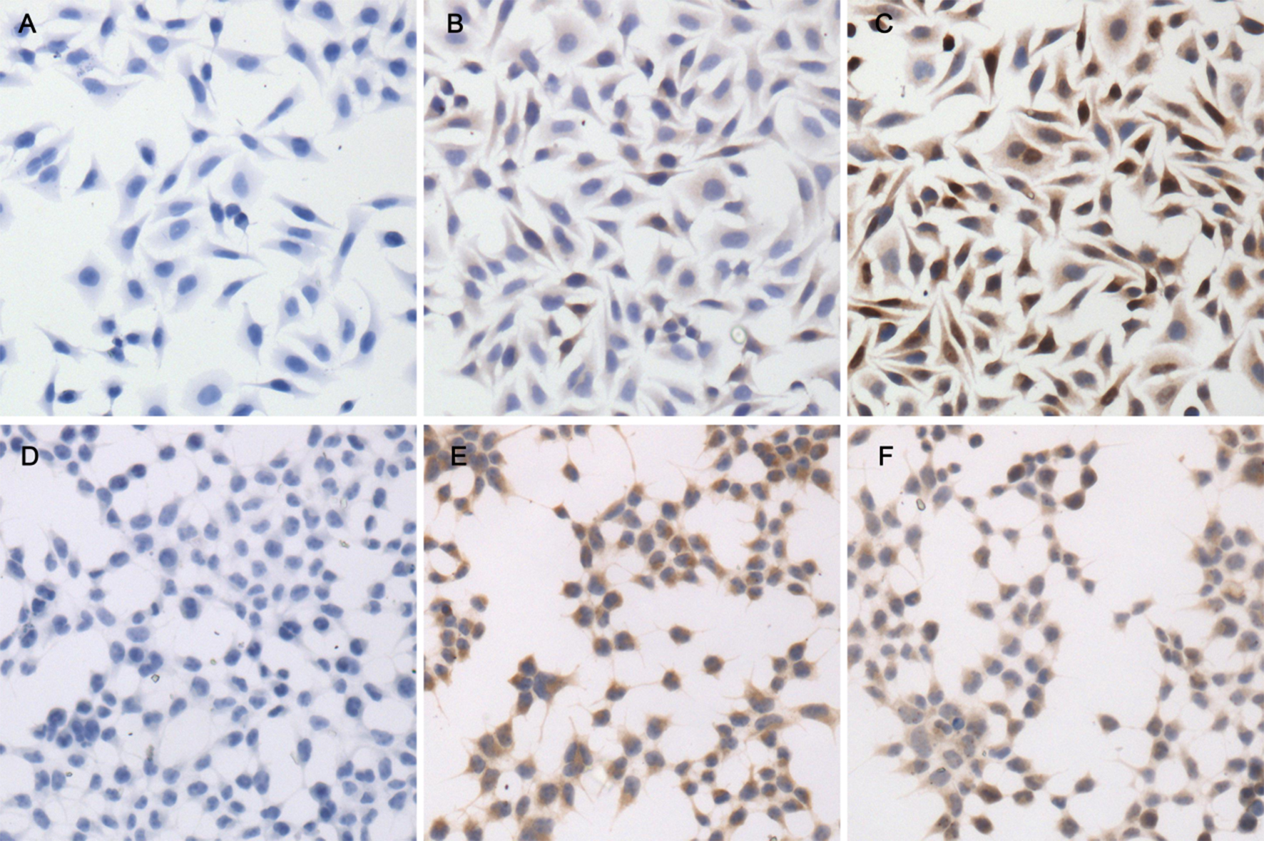 Representative images of ICC in HeLa and HEK293 cells. (A) Blank control in HeLa cells. (B) FHIT expression in HeLa cells. (C) MYC expression in HeLa cells. (D) Blank control in HEK293 cells. (E) FHIT expression in HEK293 cells. (F) MYC expression in HEK293 cells. Original magnification × 200.