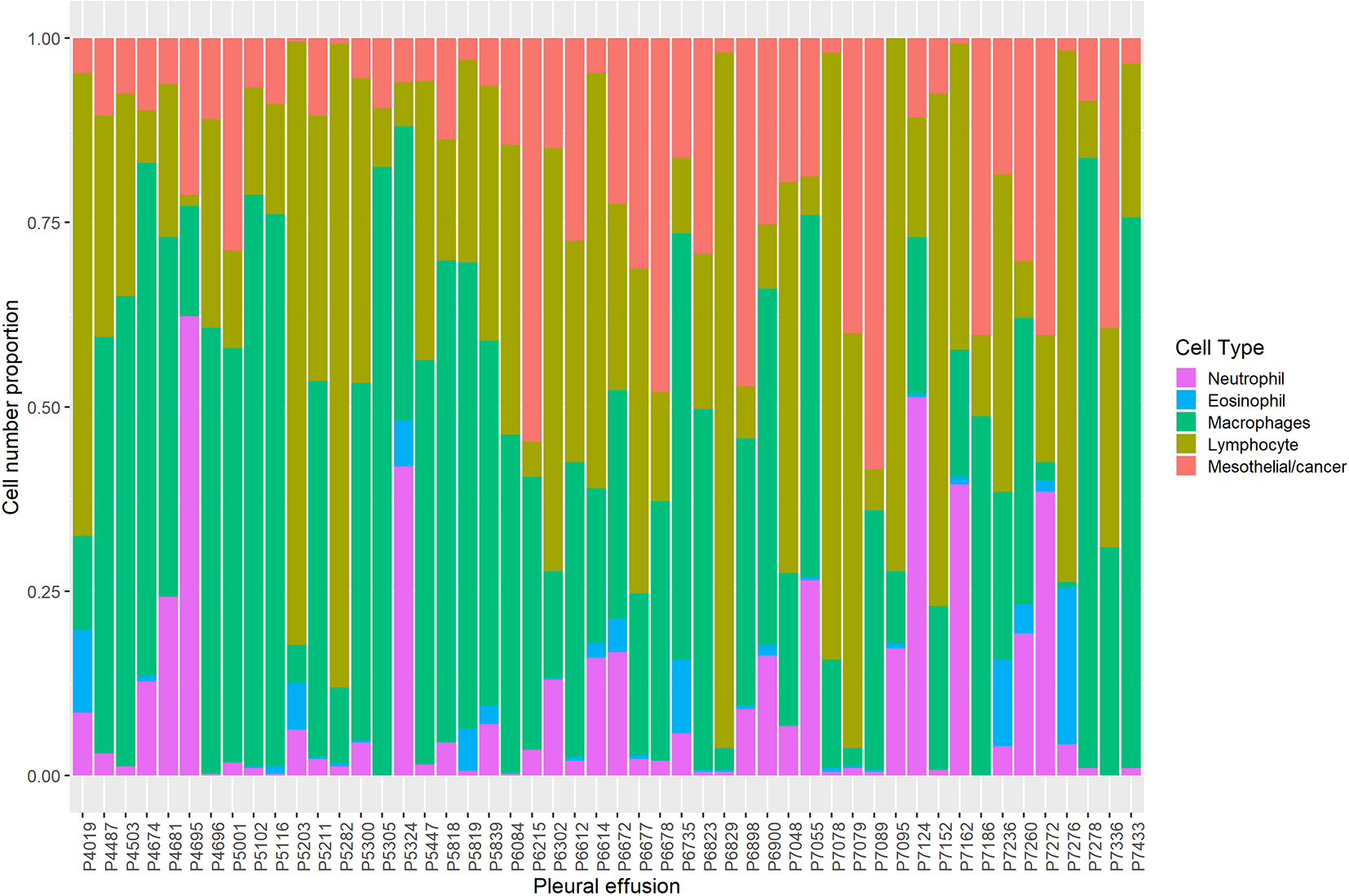 Cellular composition of pleural effusions, determined from a cell count of approximately 400 cells.