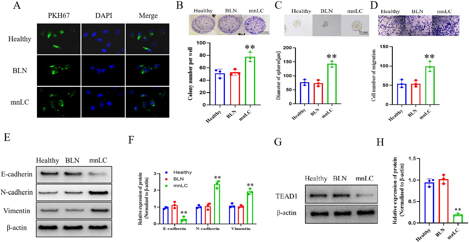 sEVs enhance the proliferation, stemness, migration ability, invasion and TEAD1 related protiens of lung cancer A549 cells. (A) Immunofluorescence observation of the localization of green fluorescent labeled sEVs (PKH67) after incubation with lung cancer cells; (B) The effect of adding sEVs on cell clone formation ability in clone formation detection; (C) The effect of adding sEVs on cell stemness ability was detected through Stem cell sphere-forming assay; (D) Transwell assay was used to detect the effect of adding sEVs on cell migration ability. (E) Representative lung cancer cell A549 invasion related protein band diagram; (F) Histogram of expression of invasion related proteins in A549 lung cancer cells; (G) Intracellular TEAD1 protein band diagram of representative lung cancer cell A549; (H) Histogram of TEAD1 protein expression in A549 lung cancer cells. ** P< 0.01, compared to the BLN and Healthy groups. All the results are representative of three independent experiments.