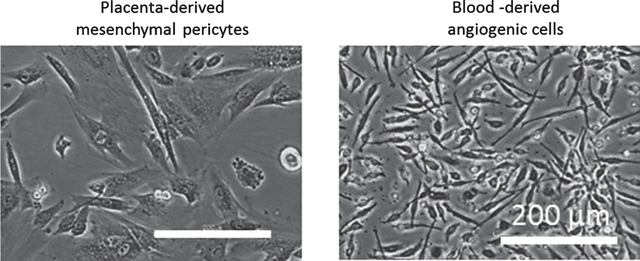 Phase contrast images of placenta-derived mesenchymal pericytes and blood-derived angiogenic cells, which resemble hematopoietic pericytes.