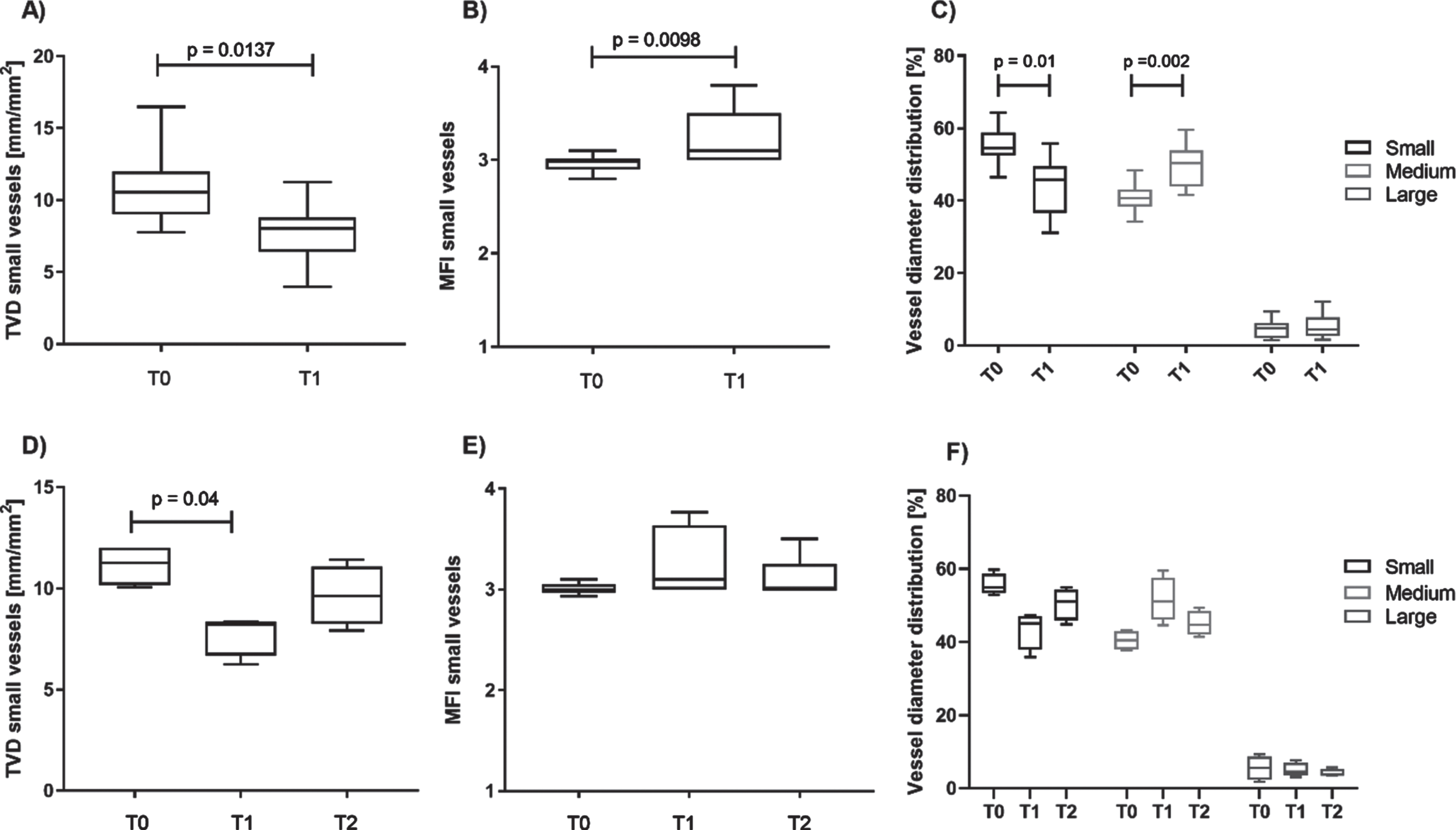 Perioperative changes of microcirculatory parameters in sublingual vessels. Panels A-C include data of all children (n = 11), panels D-F include data from a subgroup of children (n = 6) with recordings available at timepoint T2. Small vessel density (A) decreased and the microvascular flow in small vessels (B) increased significantly from T0 to T1. The proportion of small vessels (<10 μm diameter) decreased significantly during surgery, while the proportion of medium vessels (10-25 μm diameter) increased significantly (C). Follow-up recordings 6 h post-surgery (T2) demonstrate a return of small vessel density (D), MFI (E), and diameter distribution (F) towards preoperative values.