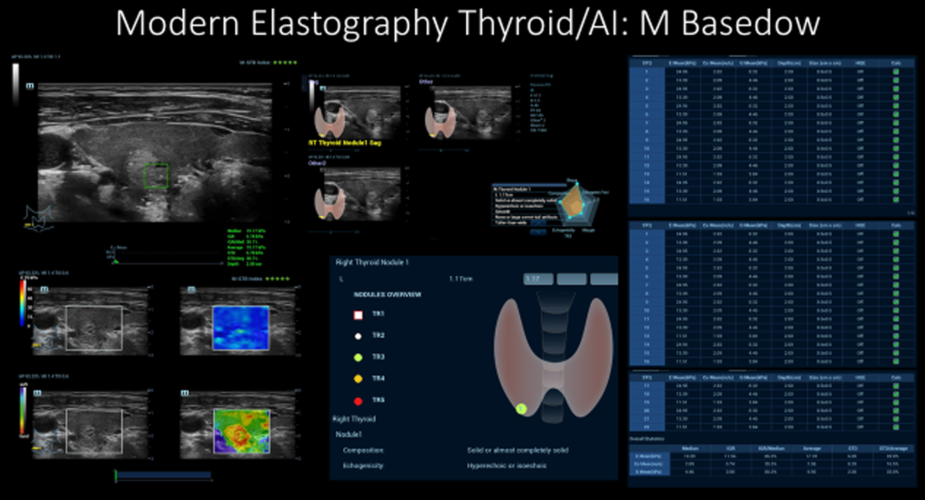 Modern multimodal thyroid diagnostics with artificial intelligence (AI).